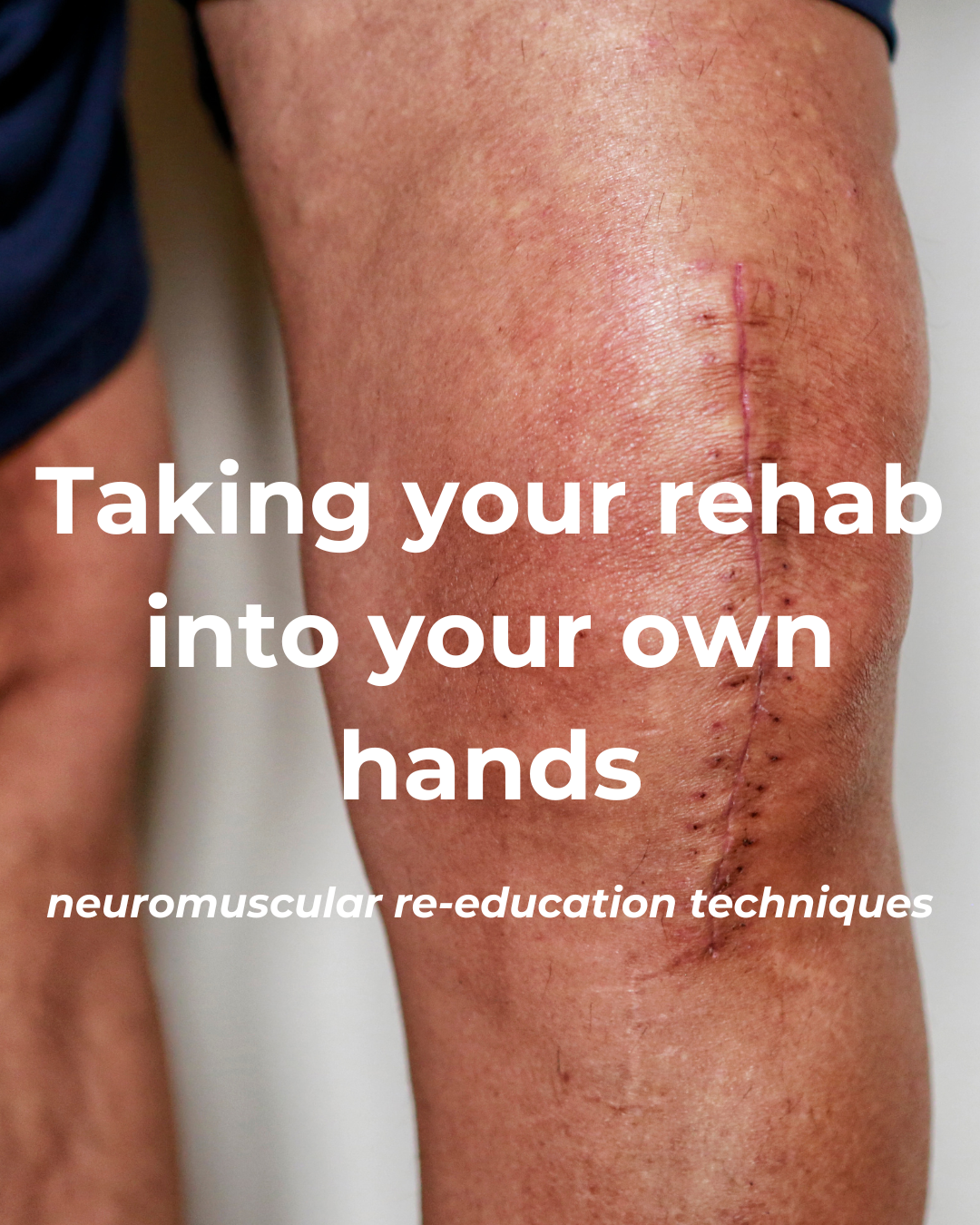 Taking Your Rehab Into Your Own Hands