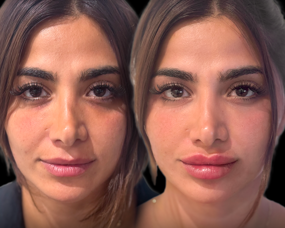 Close-up of a woman's face shown from the front, with a mirror image of herself reflected to her right, both with similar facial features and makeup.