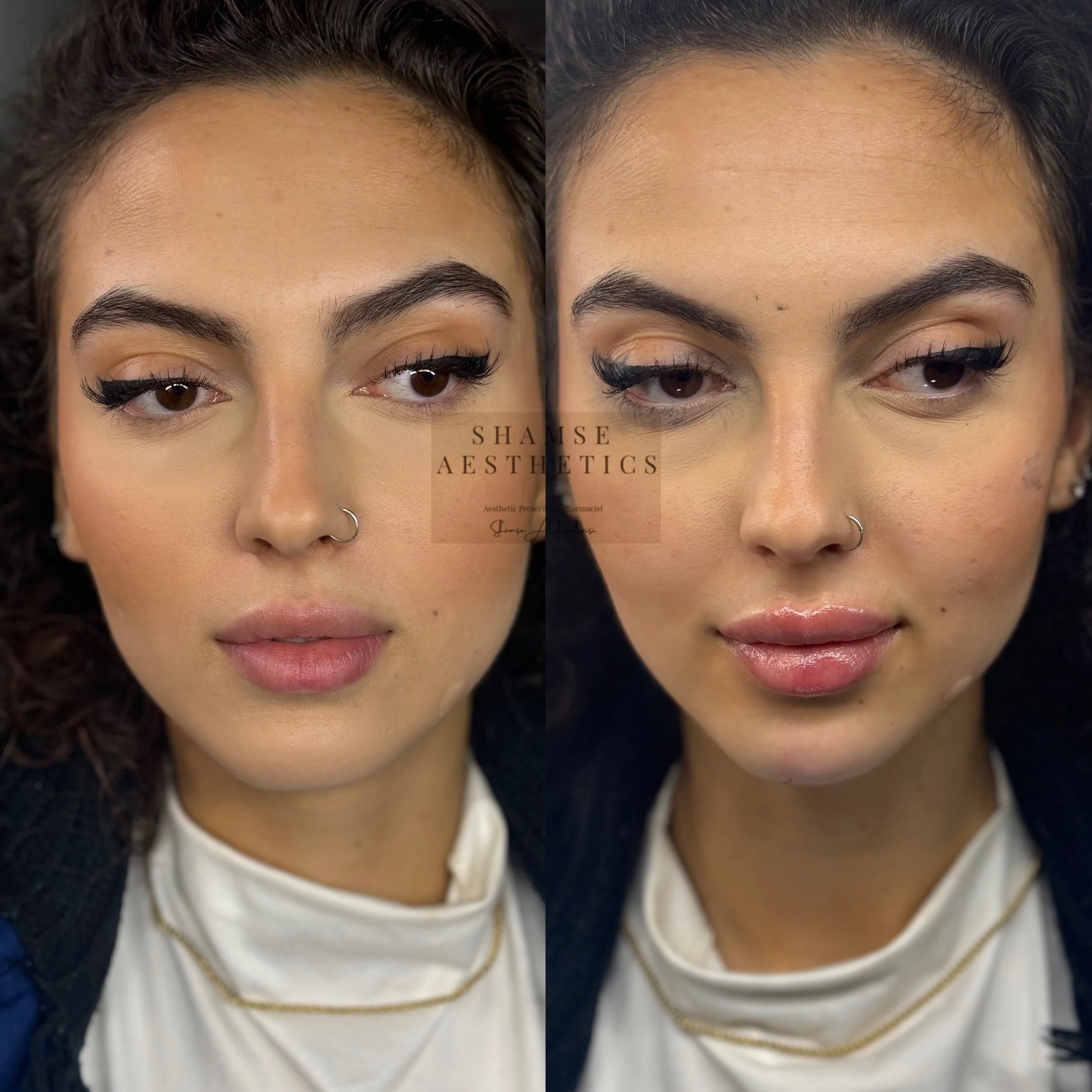 Side-by-side comparison of a woman's face before and after cosmetic treatment, showing improvements in skin texture and makeup application, with the woman wearing a white top, gold necklace, and small earrings.