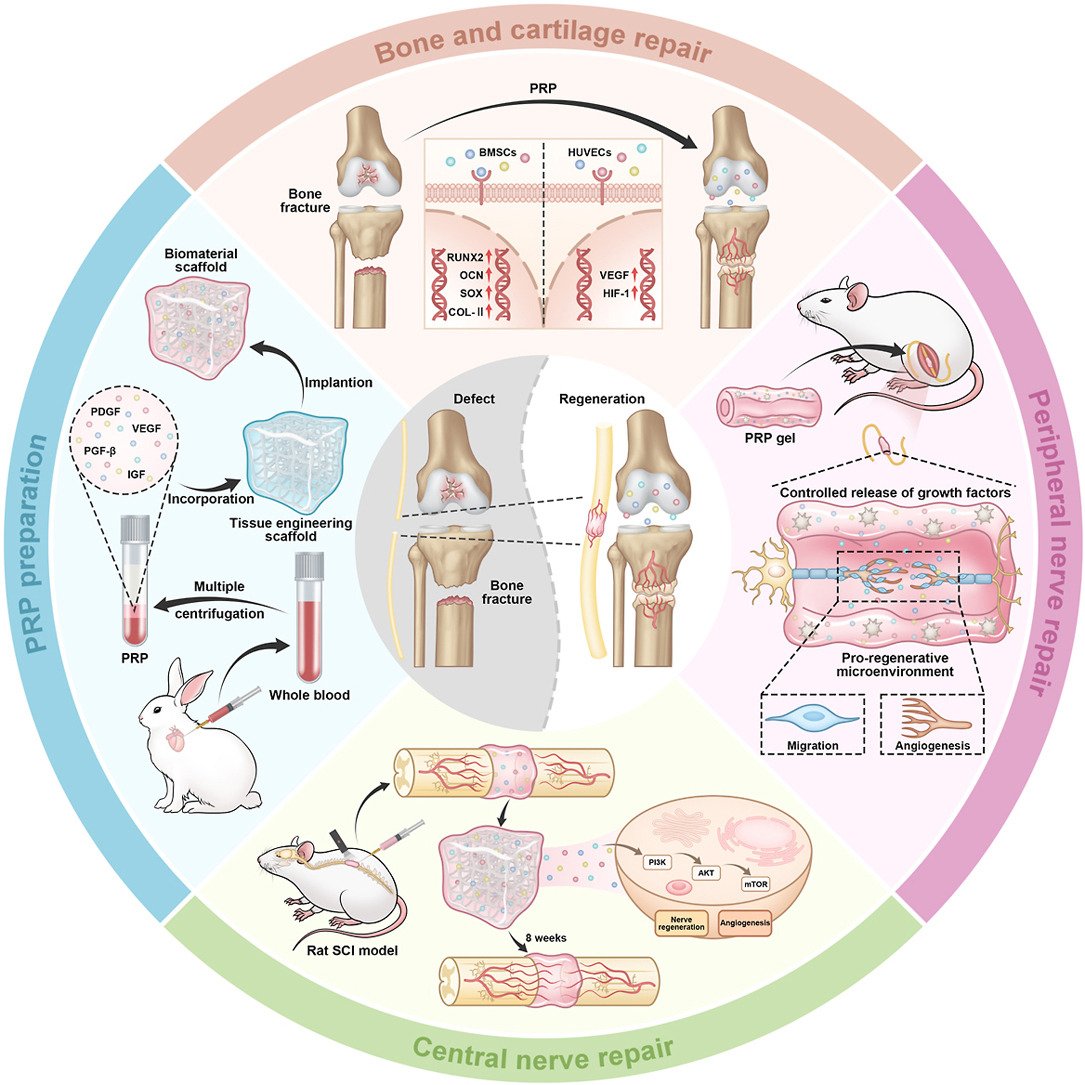 Comparative evaluation of ACRS and PRP on inflammation and lesion activity in a rat model of peritoneal endometriosis