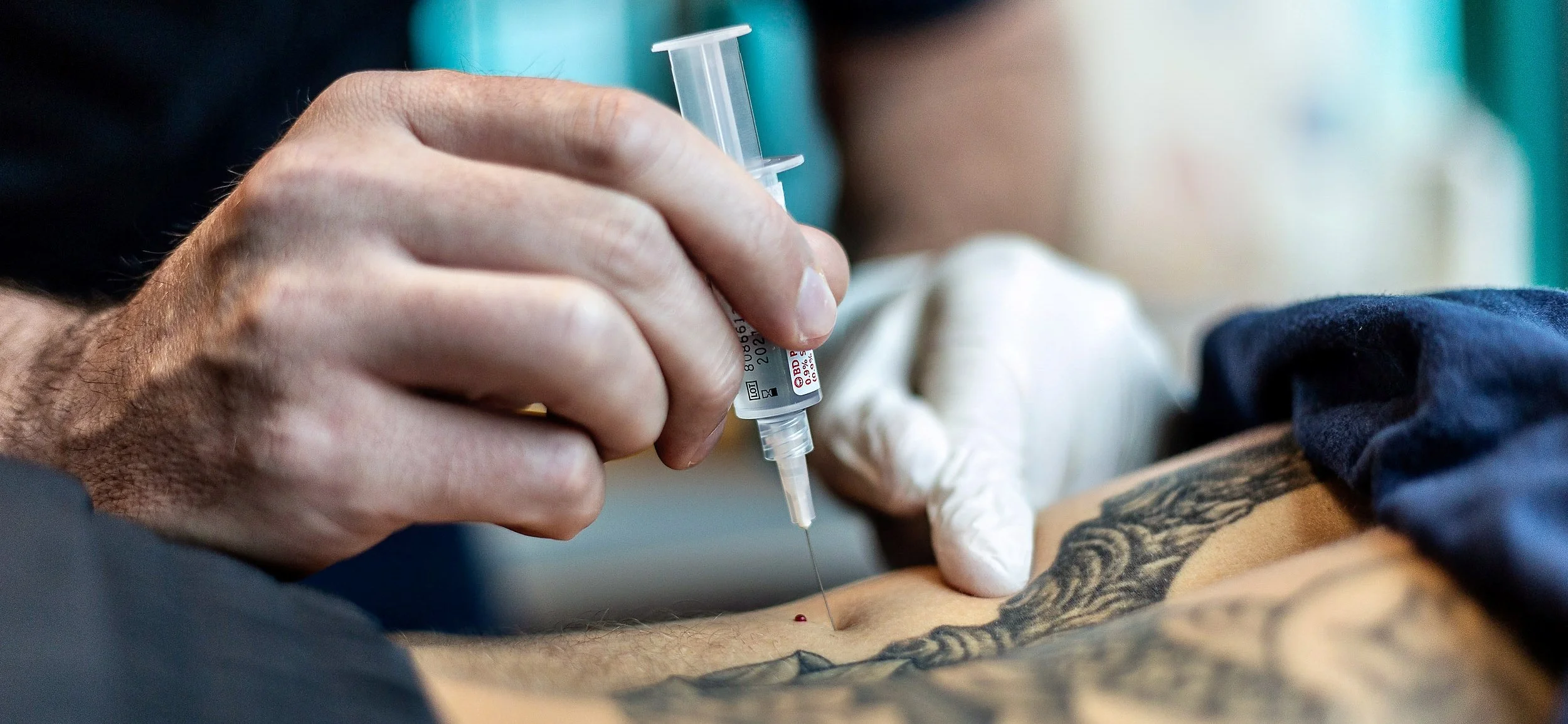 Perioperative Clinical Action Network (PCAN) Scar Release Workshop
