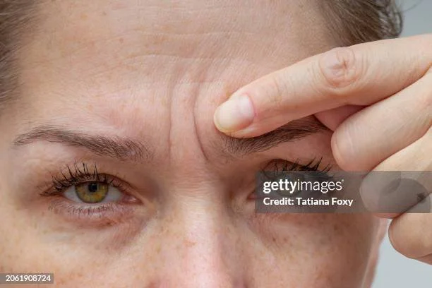 Why wrinkles don’t start on the skin - they start in the fascia