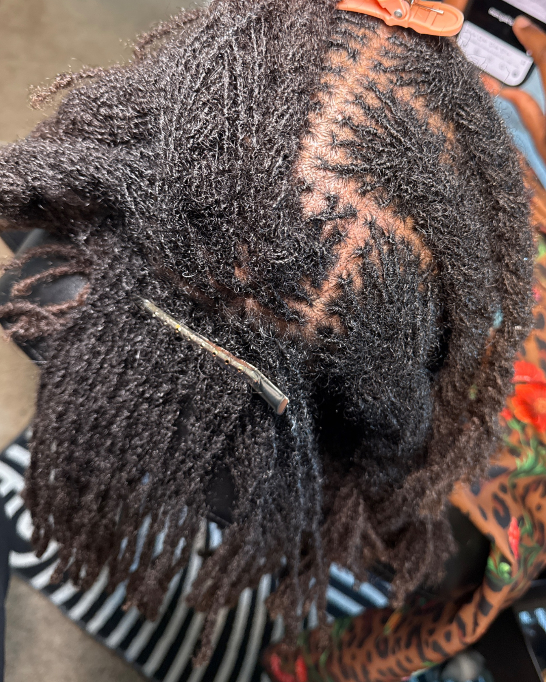 microlocs retightening results in los angeles, california