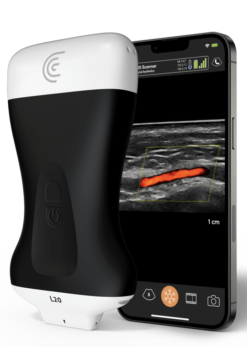 ultrasound safety in aesthetics for fillers biostimulator medical treatment for ageing cosmetic injectables hyalase dissolving fill