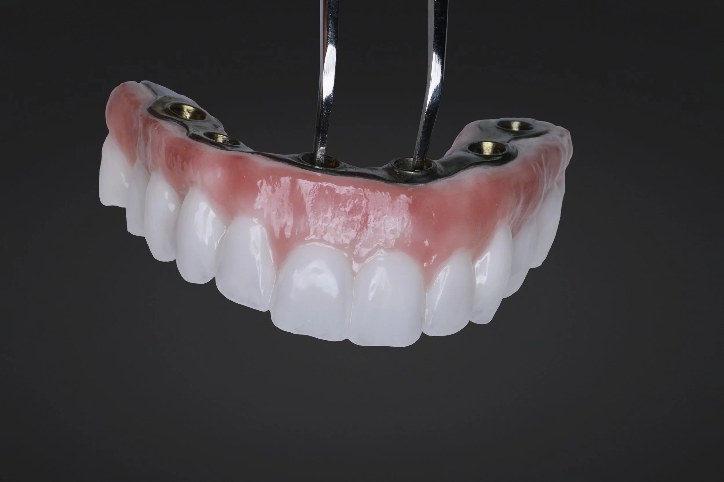 Immediate Provisional Restoration