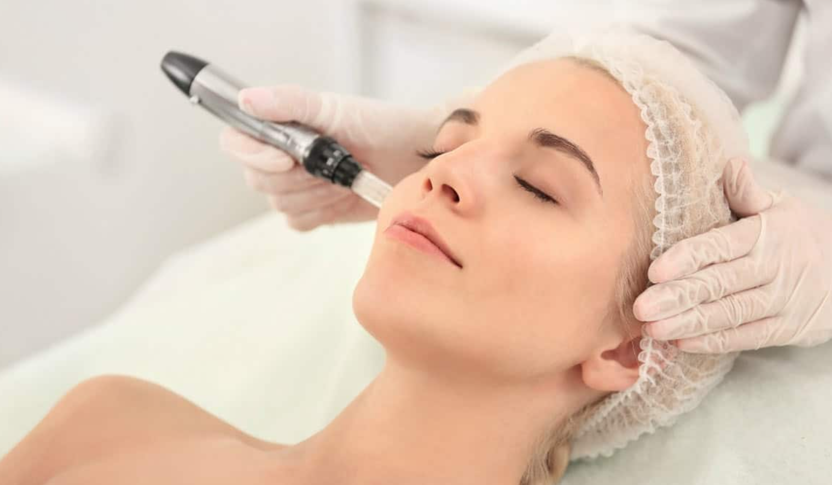 Microneedling vs. Chemical Peels: Which One Should You Choose?