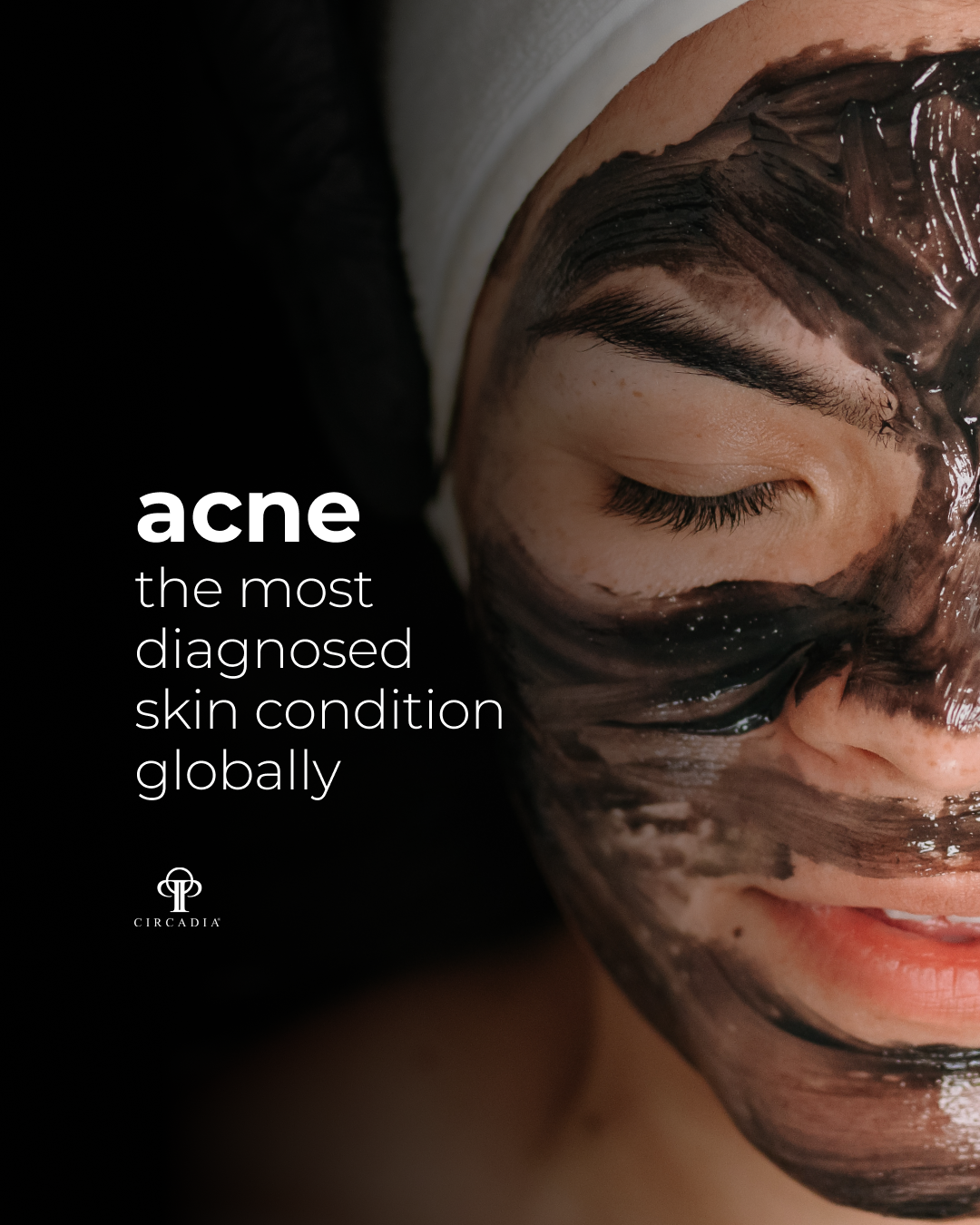 acnecondition-1.png