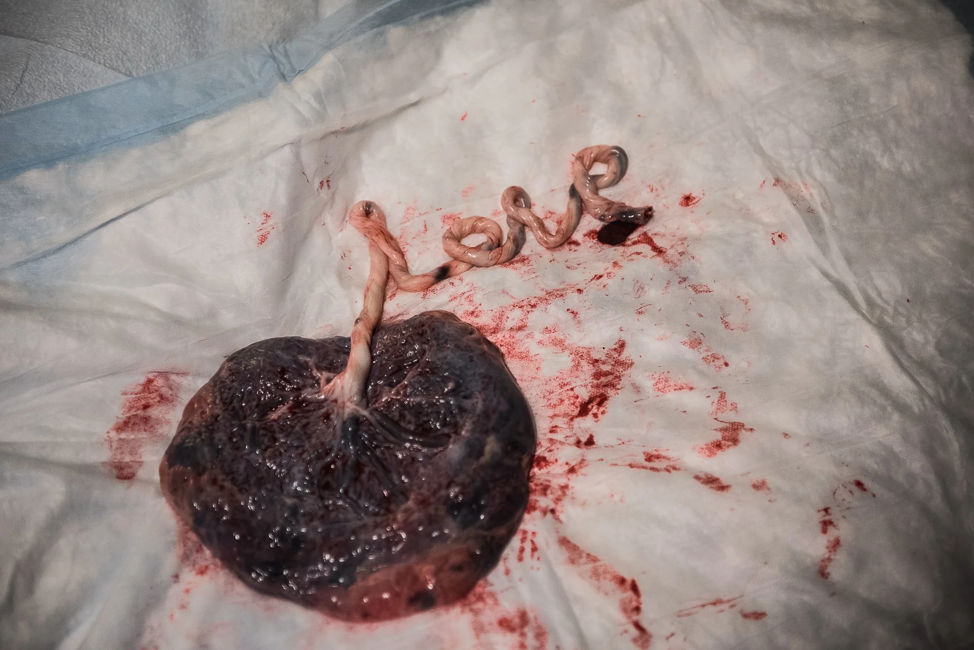 CCBirthPrep - plac. 8 [web].jpg