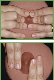 reverse pressure softening