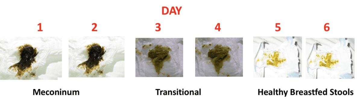 what does normal baby poop look like?