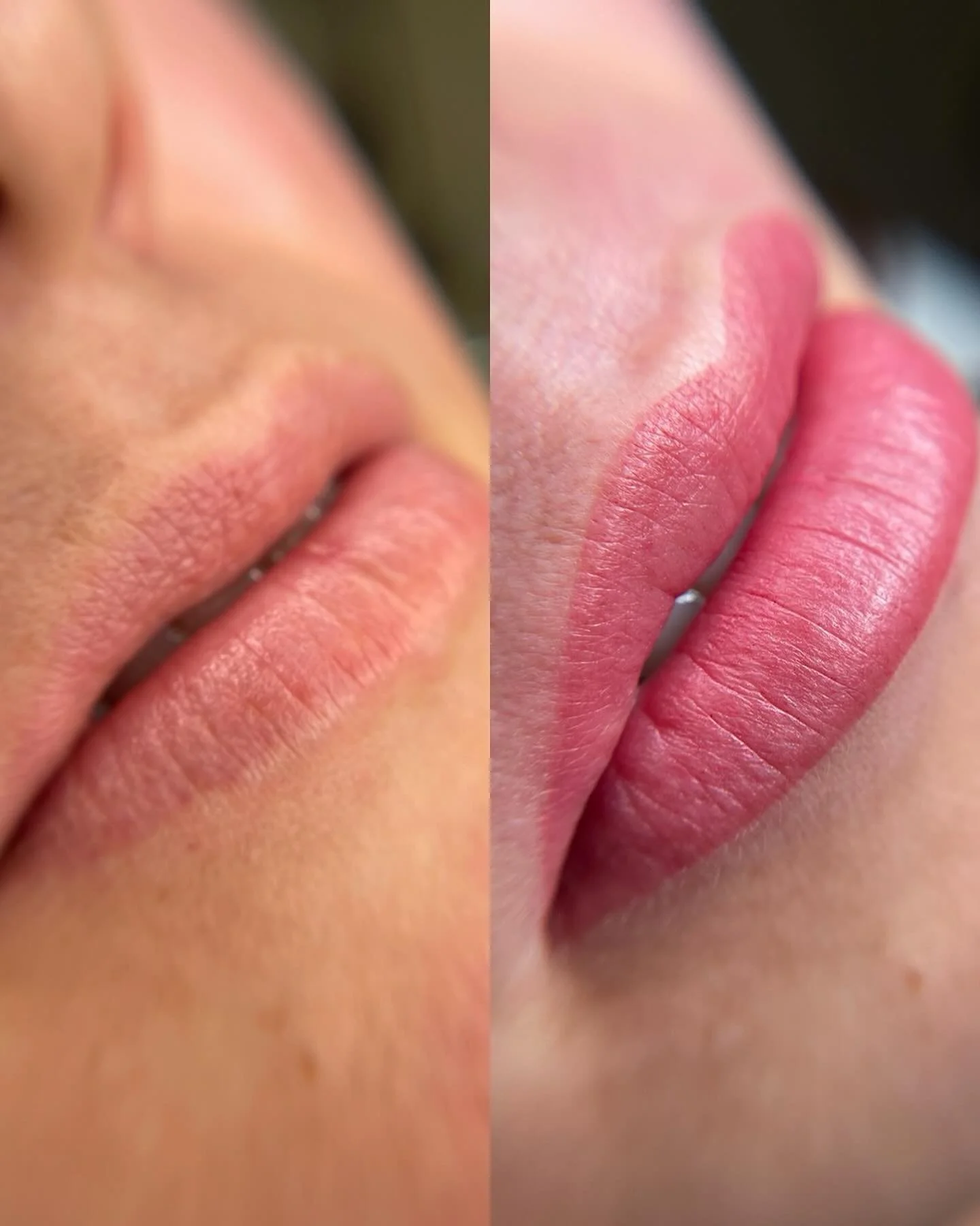 Why get your lips done?

Because waking up with natural color, defined shape, and no smudged lipstick just&nbsp;*hits different*. 💋✨

Low maintenance, high confidence, every single day.

Ready for your lip blush moment?

#lip #lips #lipblushing