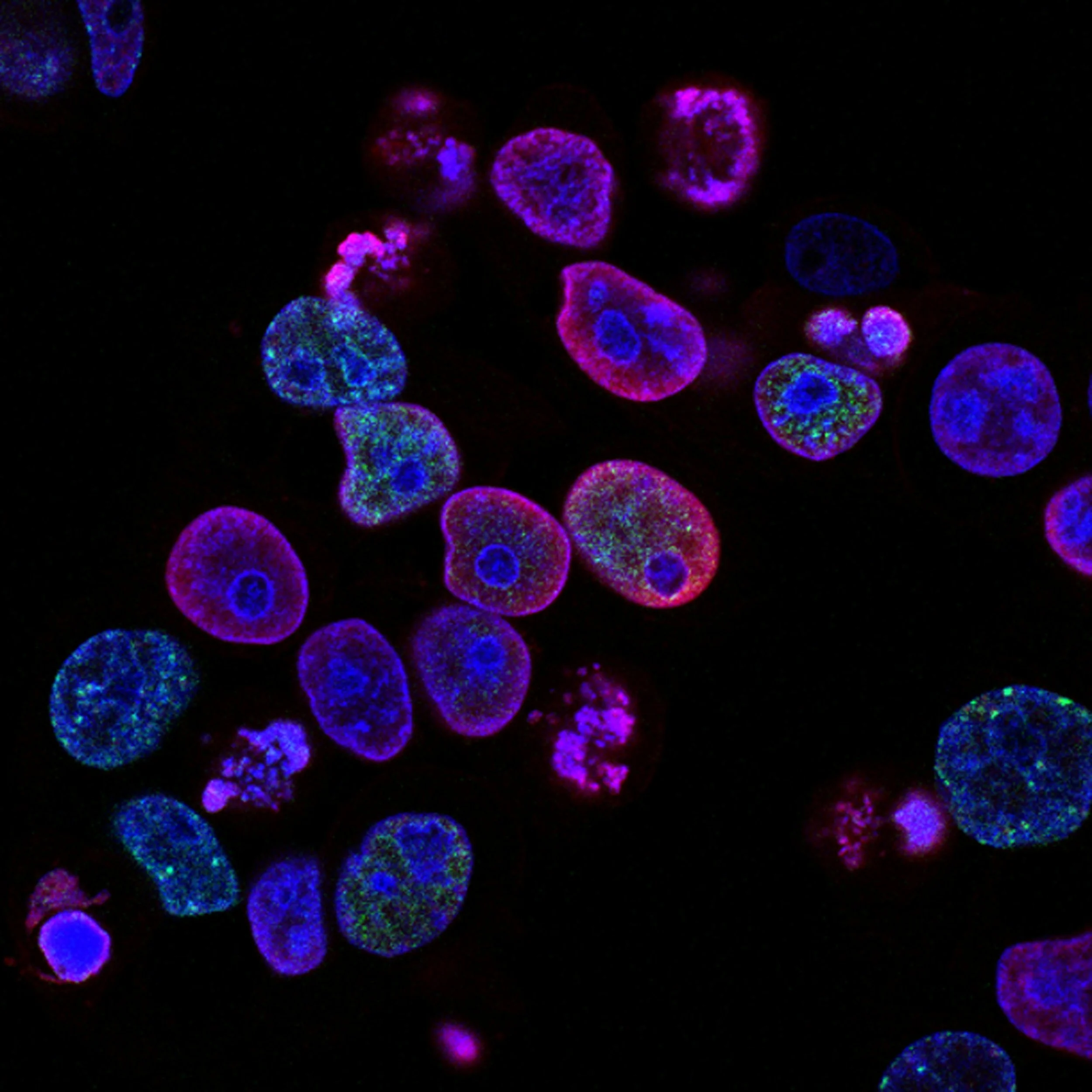 Troncalidad en el cáncer: claves para entender su rol