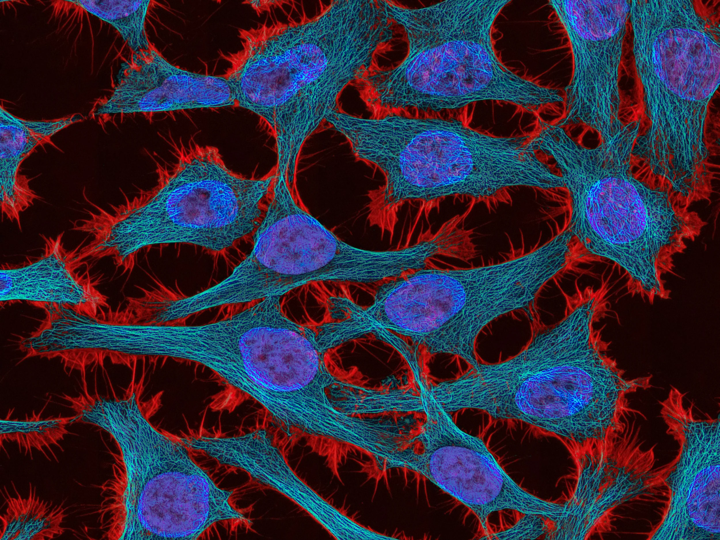 El papel de EGFR en el cáncer