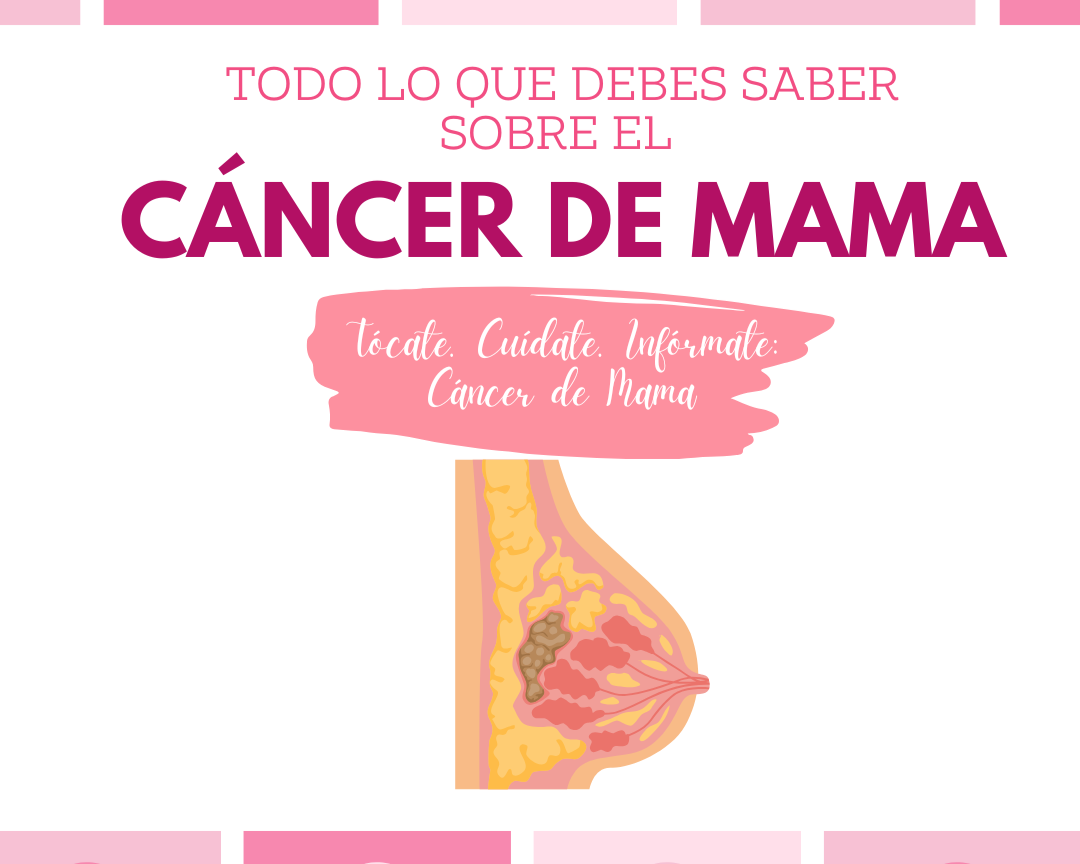 Todo lo que debes saber sobre el cáncer de mama
