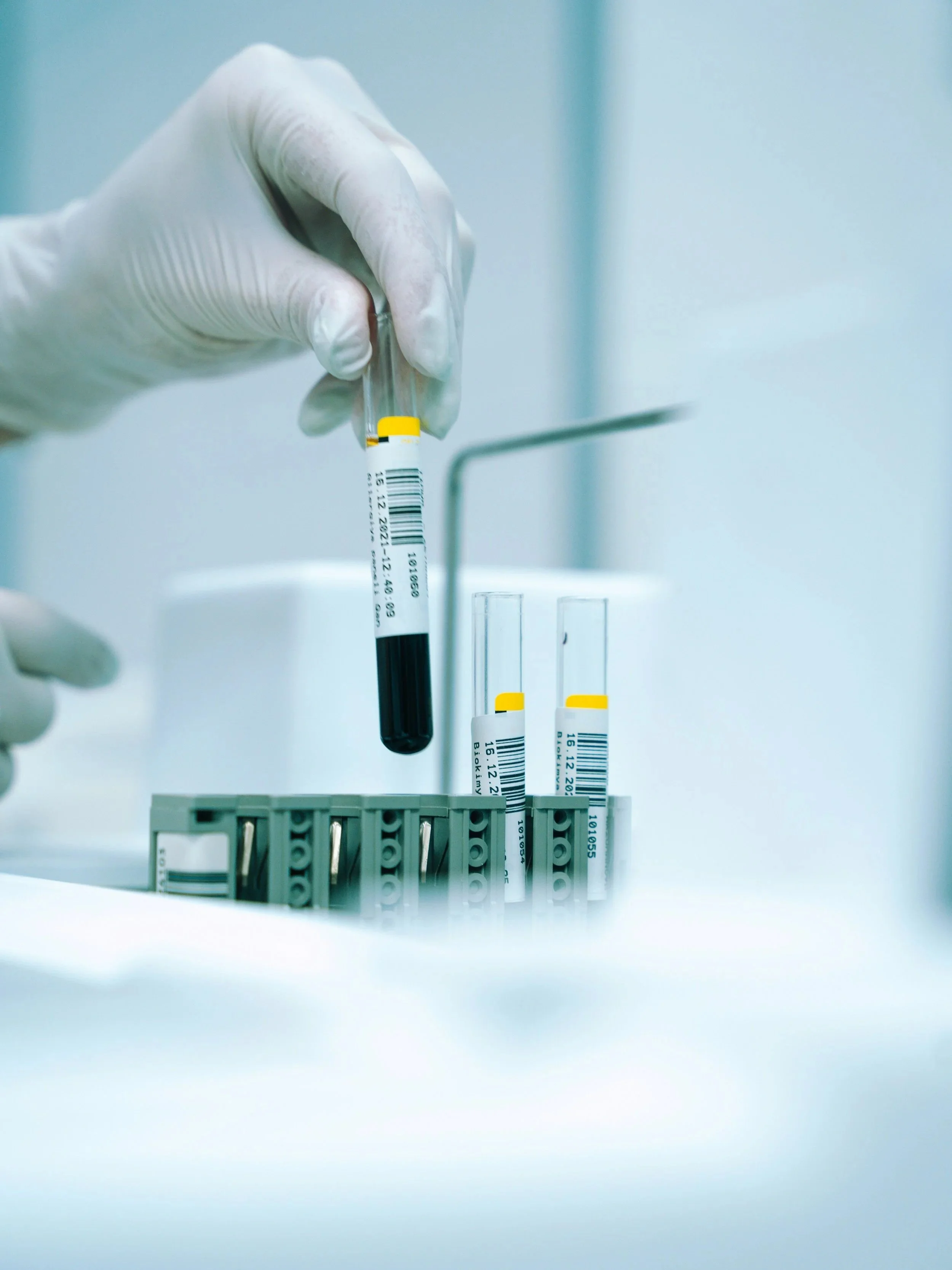 Biomarcadores de estrés en cáncer