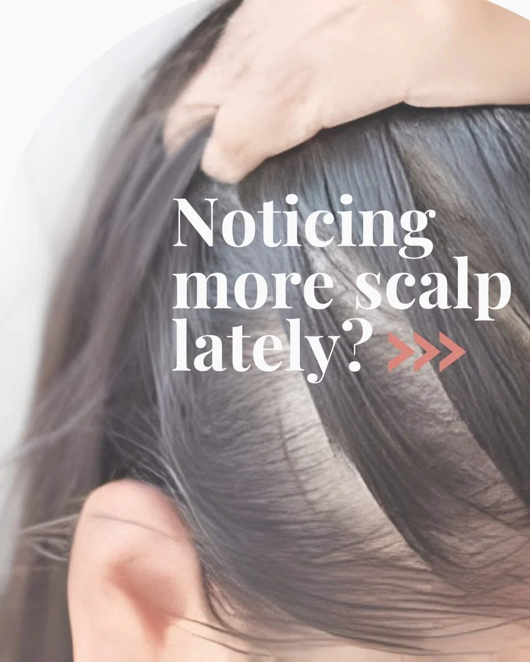 If you&rsquo;re noticing thinning, shedding or a widening part&hellip; this may be for you. 🪮

What can you expect? ✨
&bull; Support for stronger, healthier-looking hair
&bull; Improved density in thinning areas
&bull; Encouraged regrowth where foll