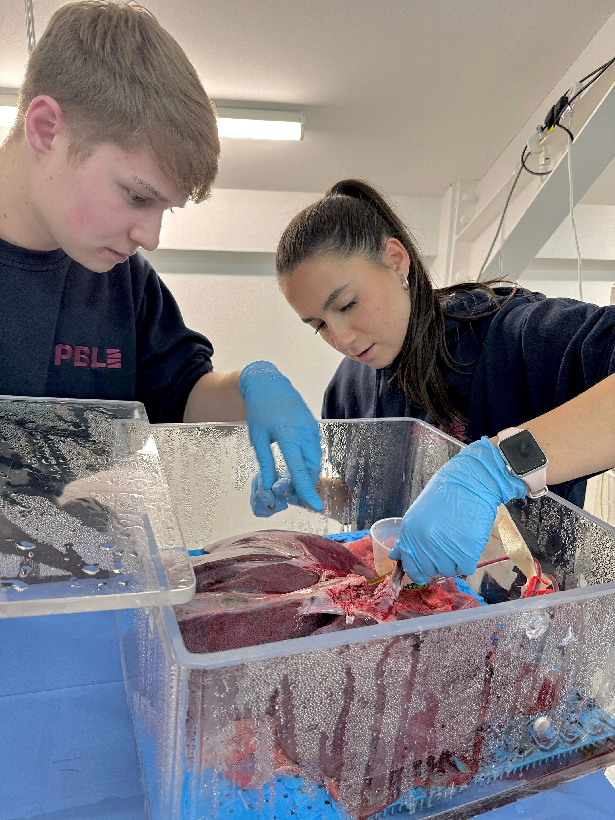 mecorbs liver zoom.jpg