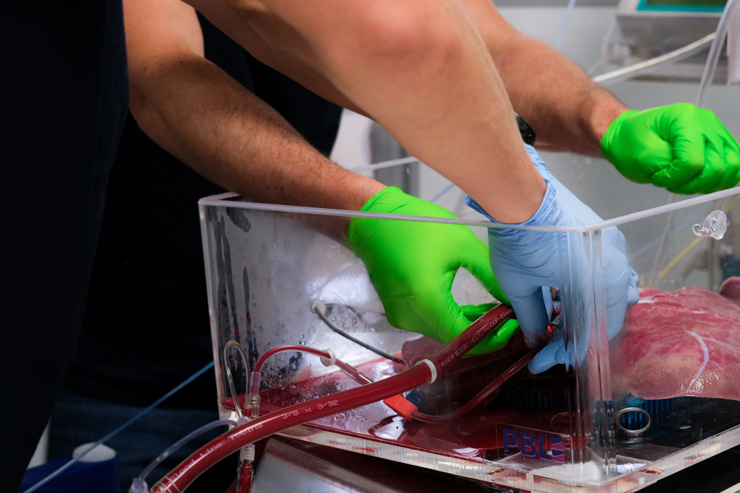 Two medical professionals wearing green and blue gloves performing an operation on a heart in a sterile environment.