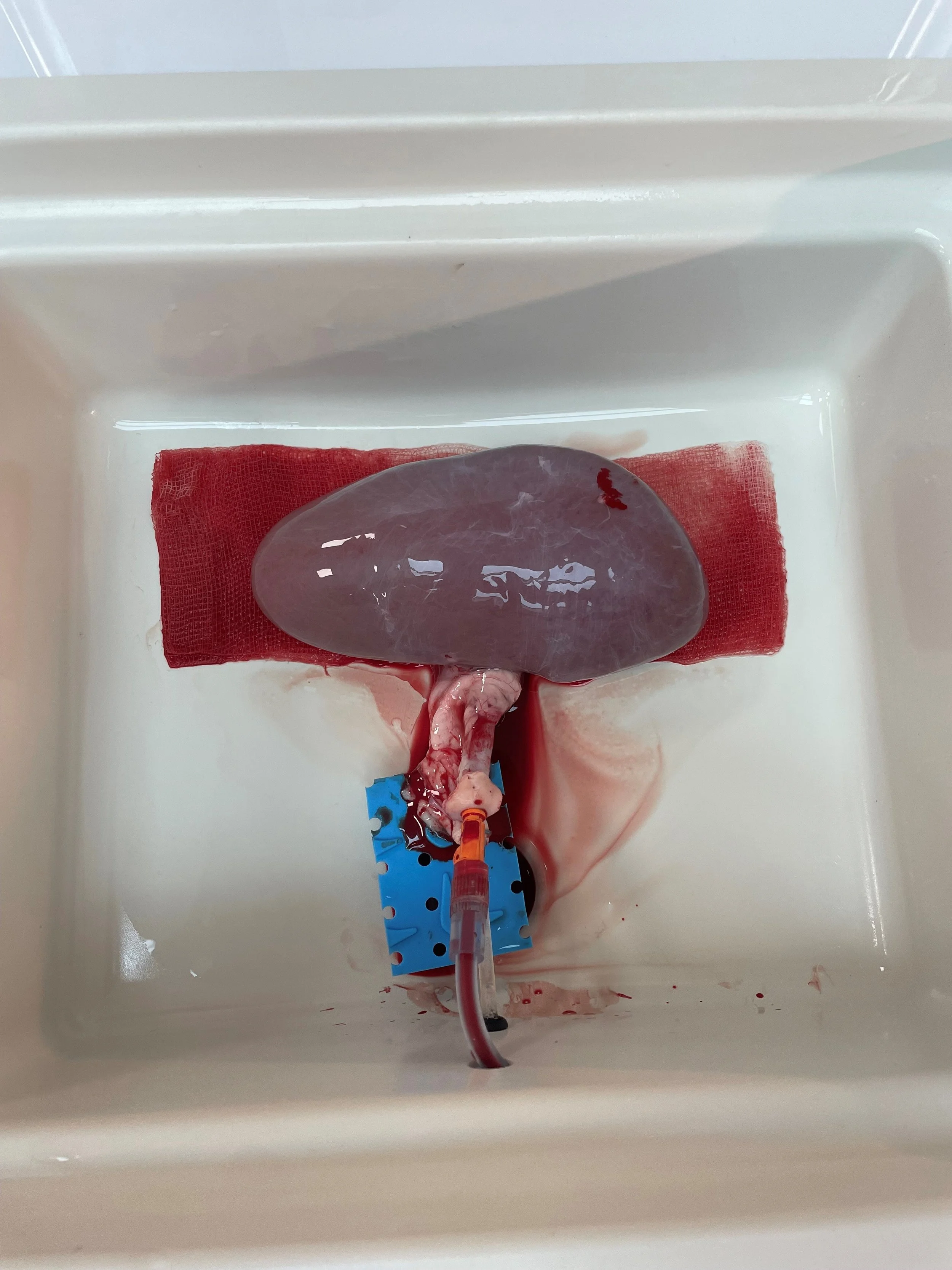 Kidney during quadrouple perfusion..jpg