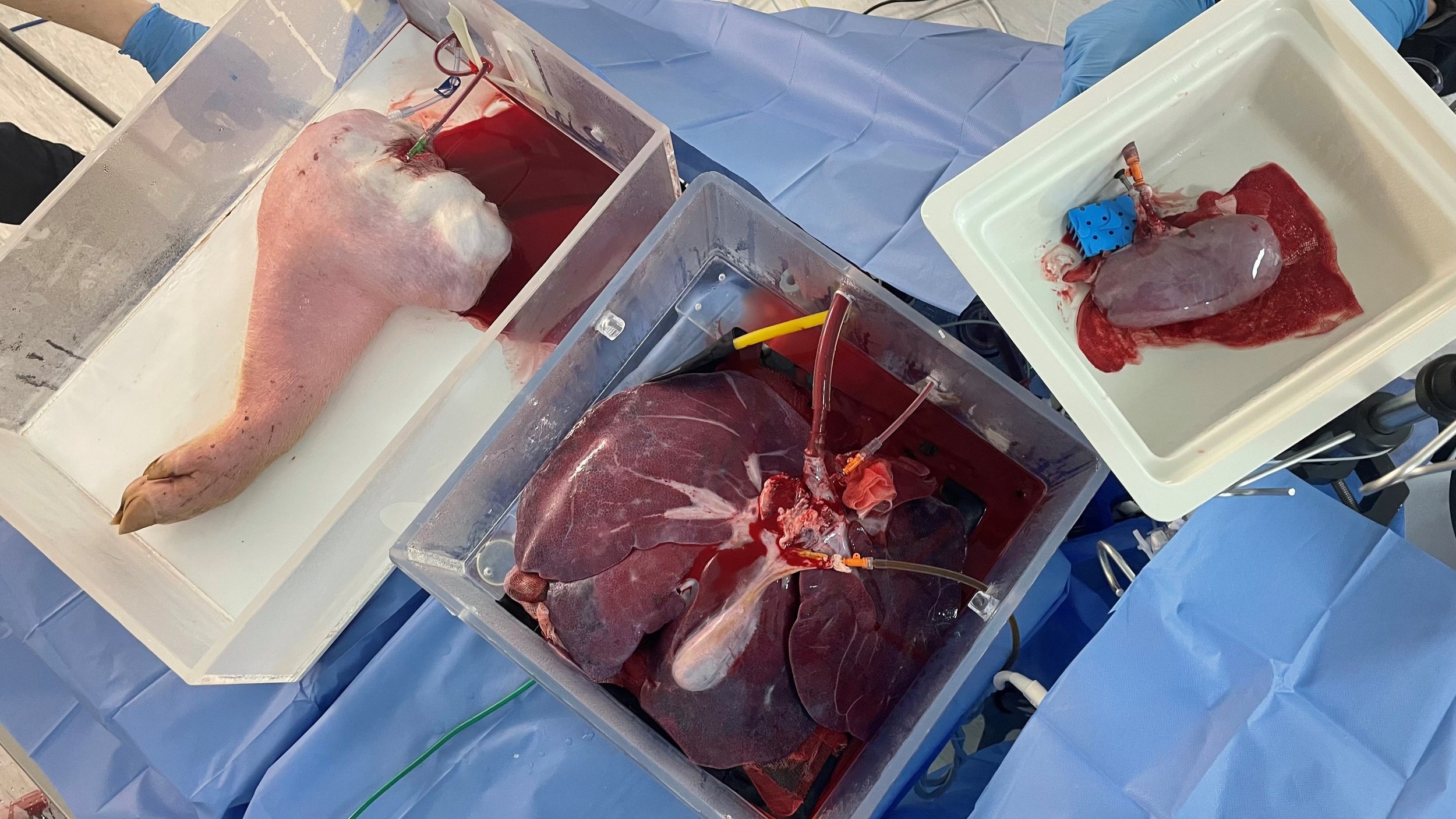 multi organ with limb.jpg