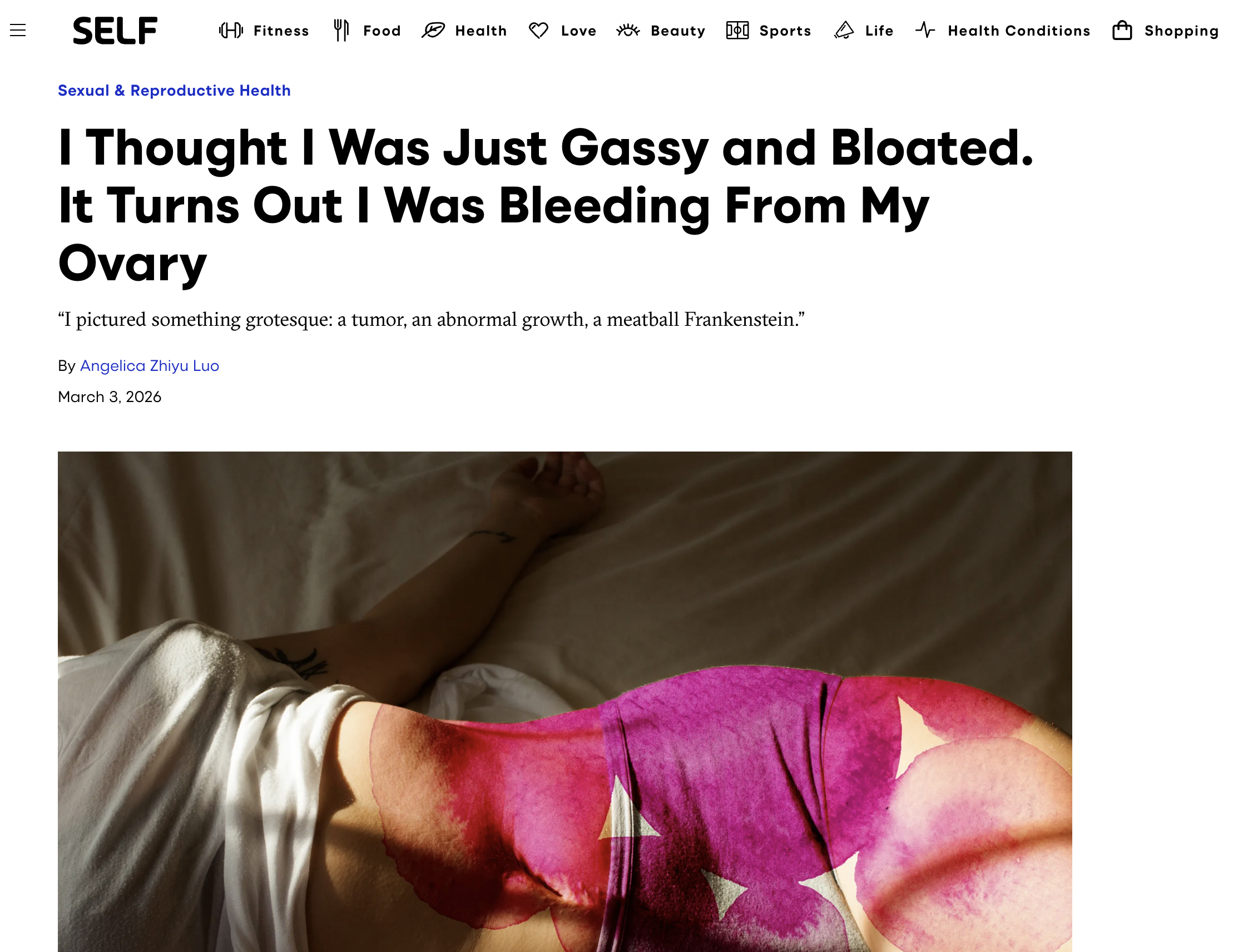 I Thought I Was Just Gassy and Bloated. It Turns Out I Was Bleeding From My Ovary