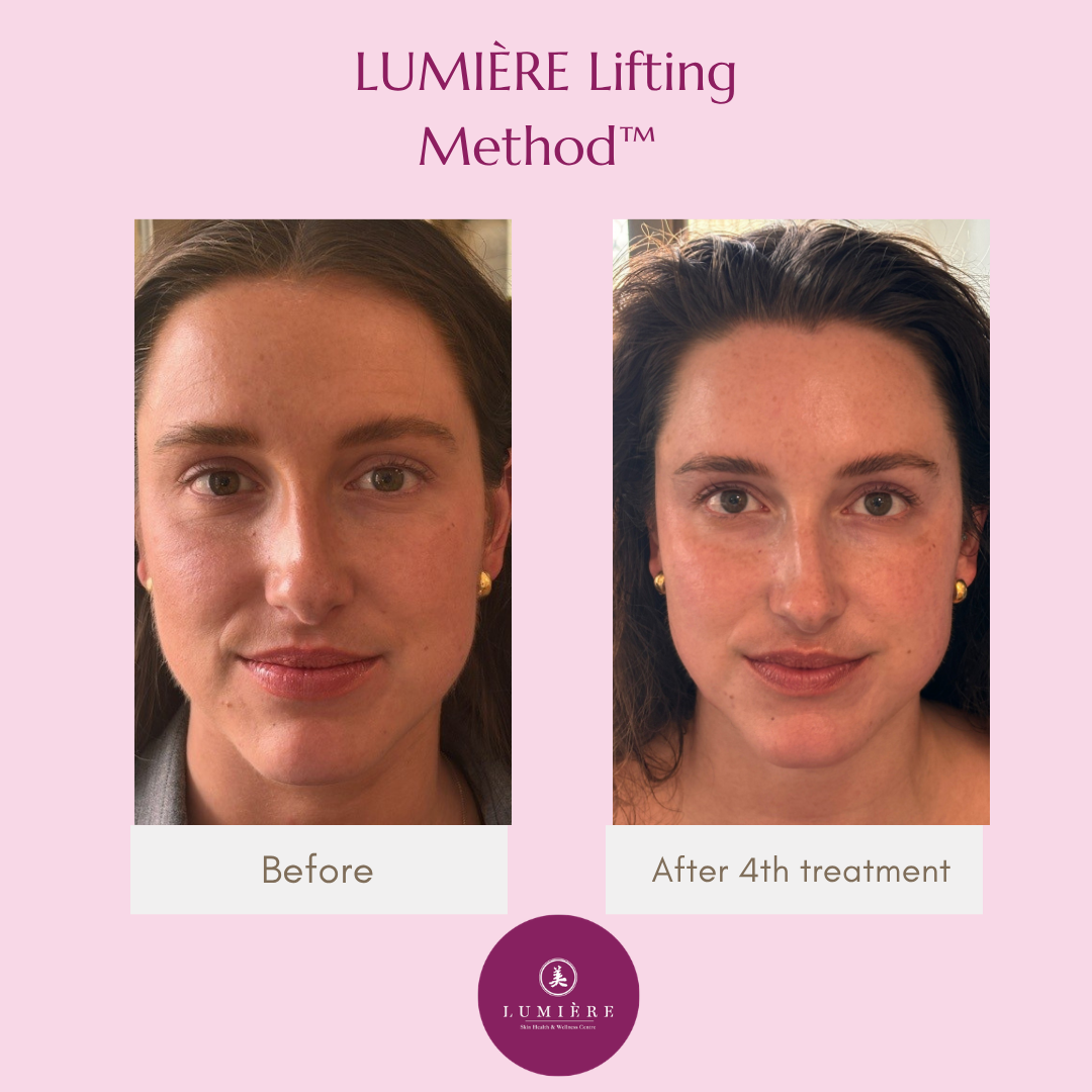 How Taylor’s Face Changed in Just 4 Weeks — By Releasing Jaw Tension