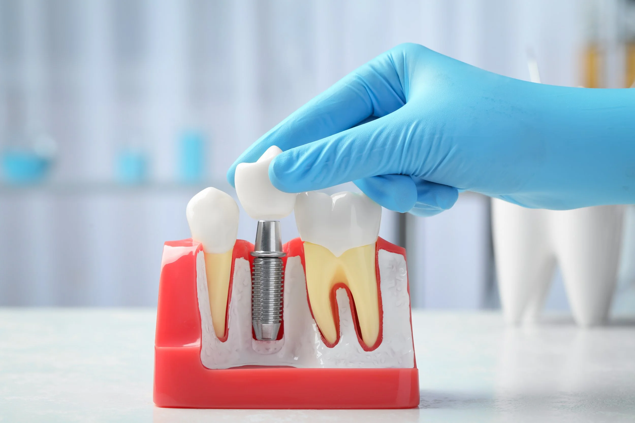 CIRUGIA E IMPLANTES buenos aires