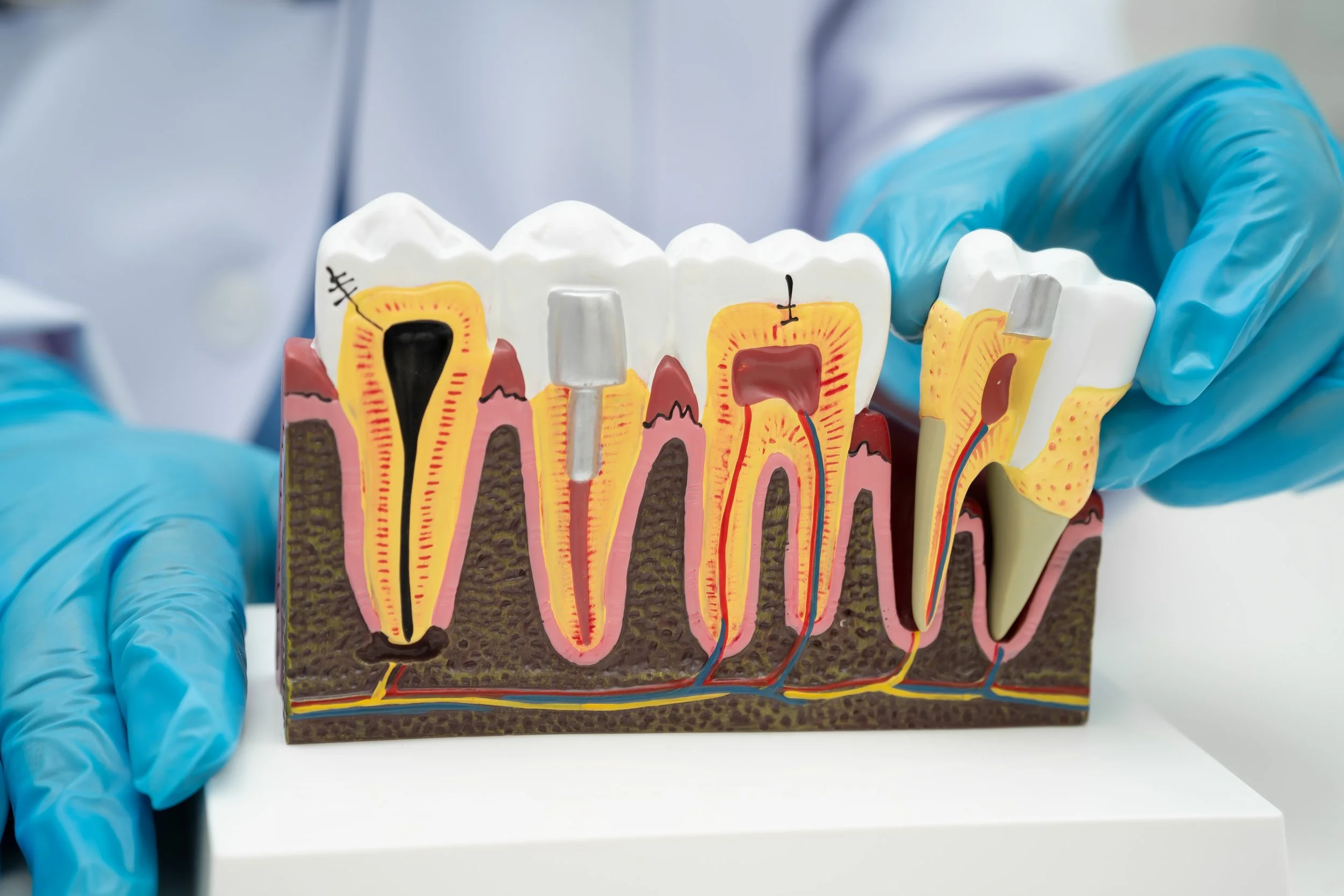 PERIODONCIA