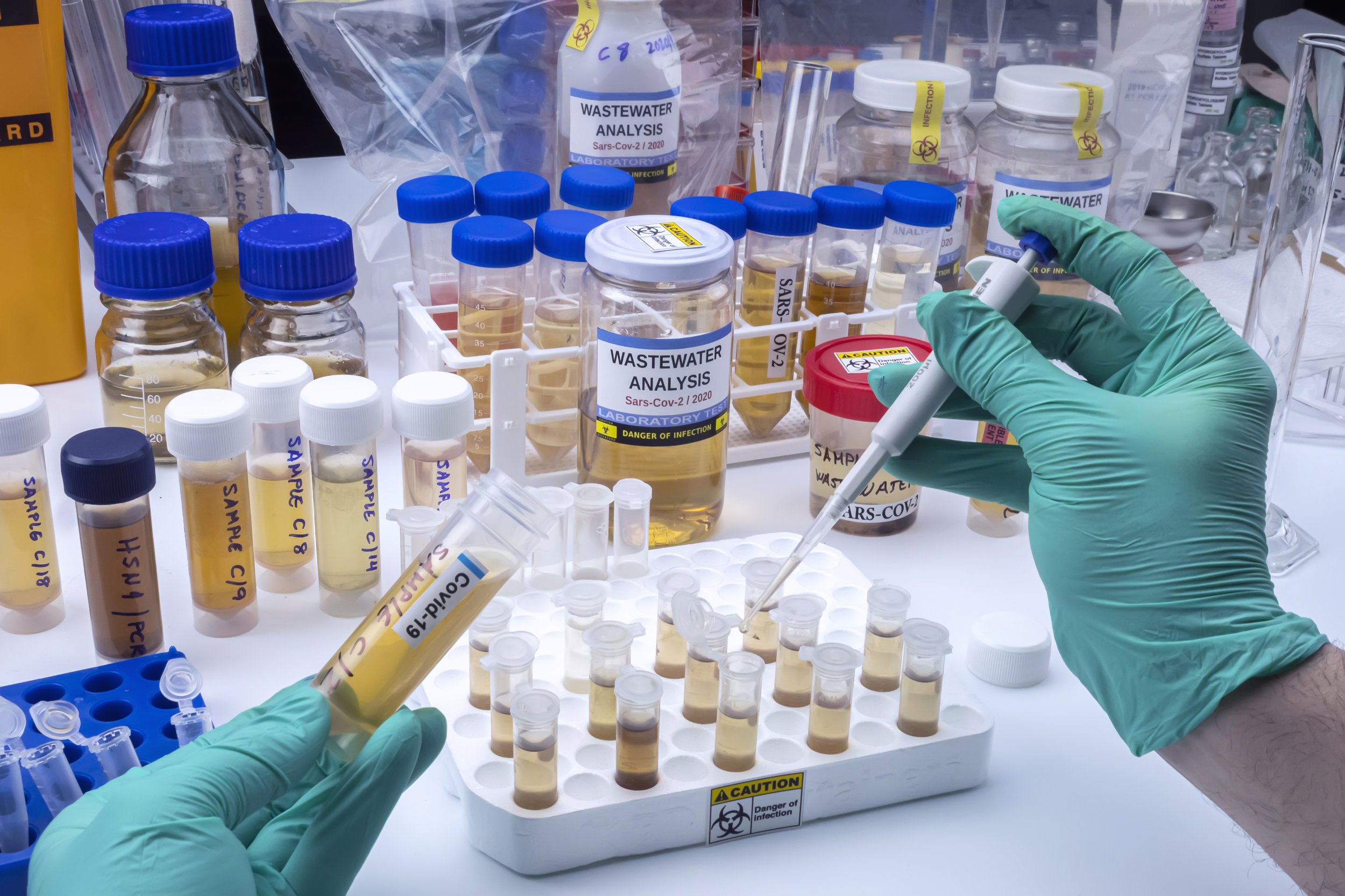 Close up of scientist investigating sars-cov-2 virus from wastewater samples in a laboratory