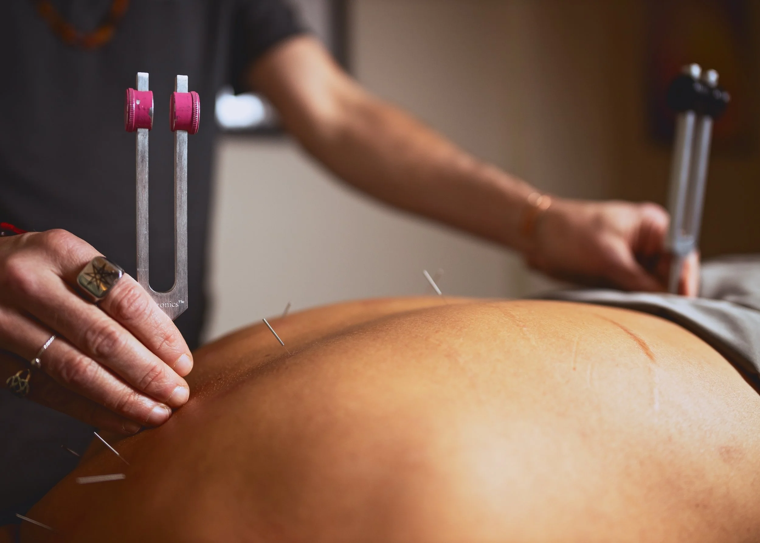 Somatic Therapy: Why Your Body Has to Heal Before Your Mind Can Move On