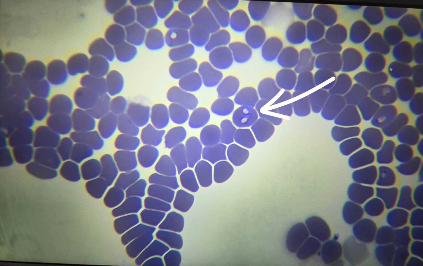 Babesioza la câini: o boală transmisă de căpușe&nbsp;care pune viața în pericol