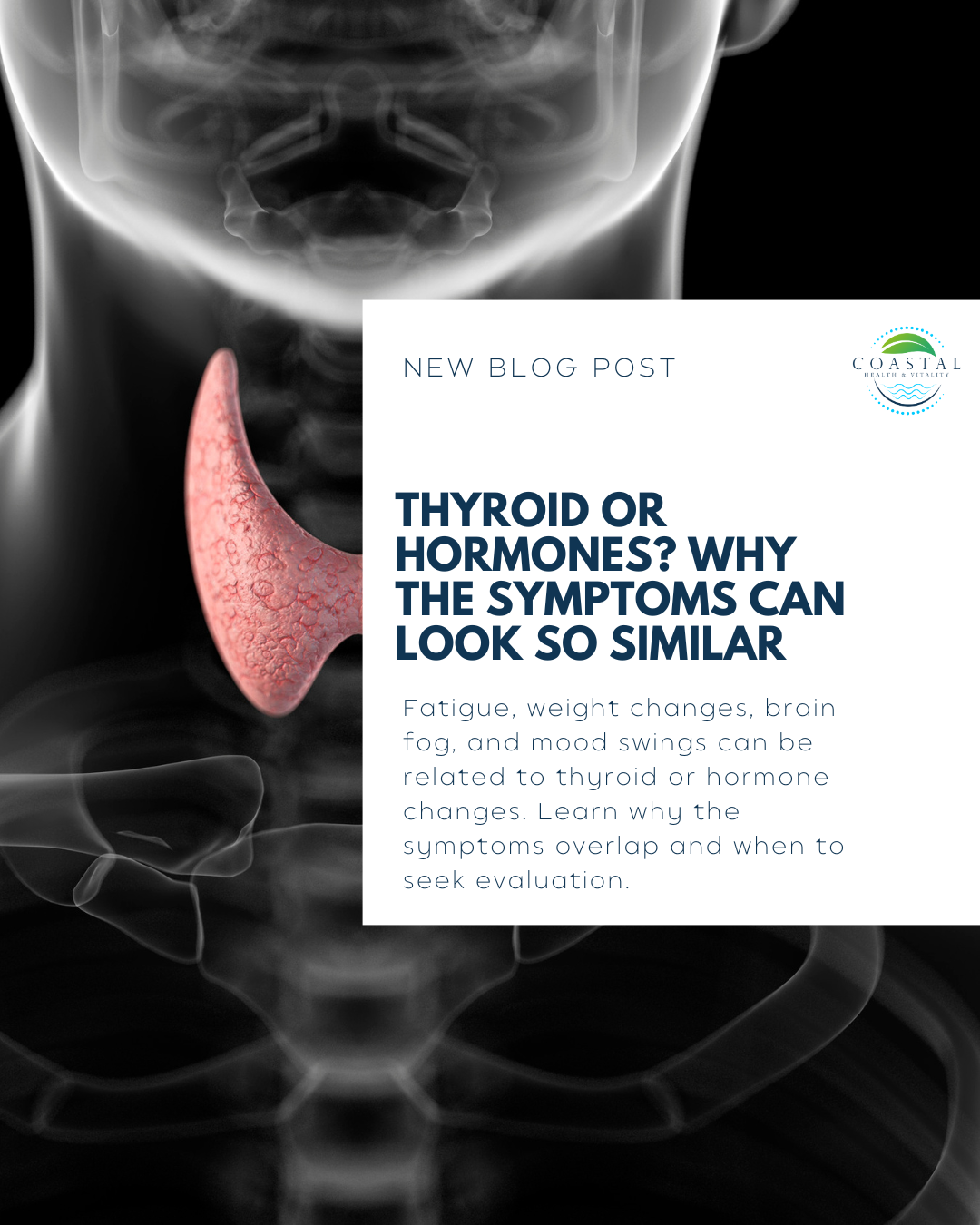 Thyroid or Hormones? Why the Symptoms Can Look So Similar