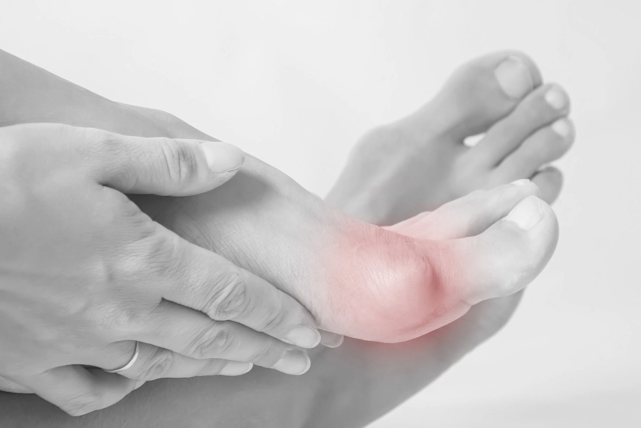Bunion Correction