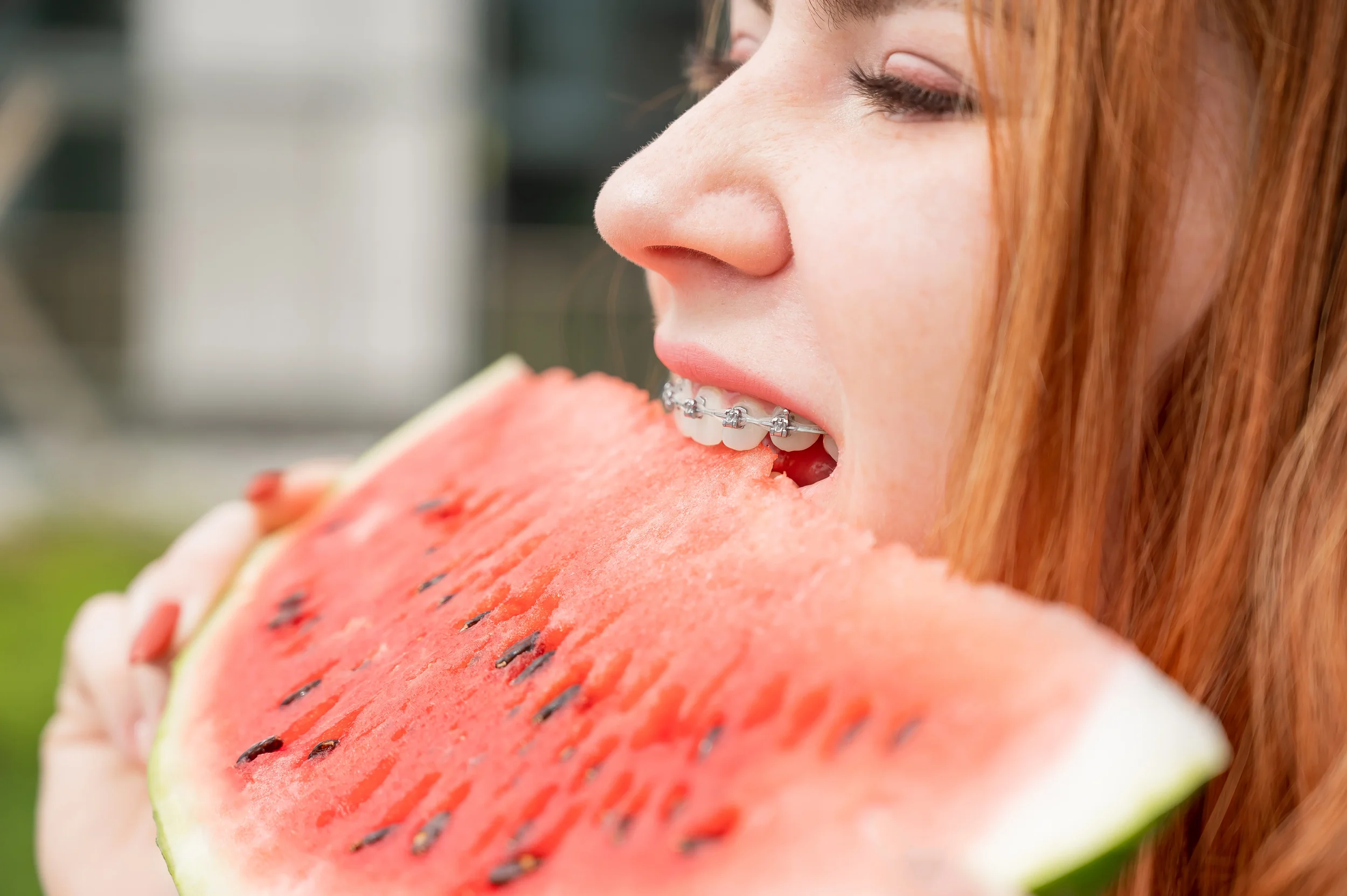 ¿Qué comer y evitar durante tu tratamiento de ortodoncia?