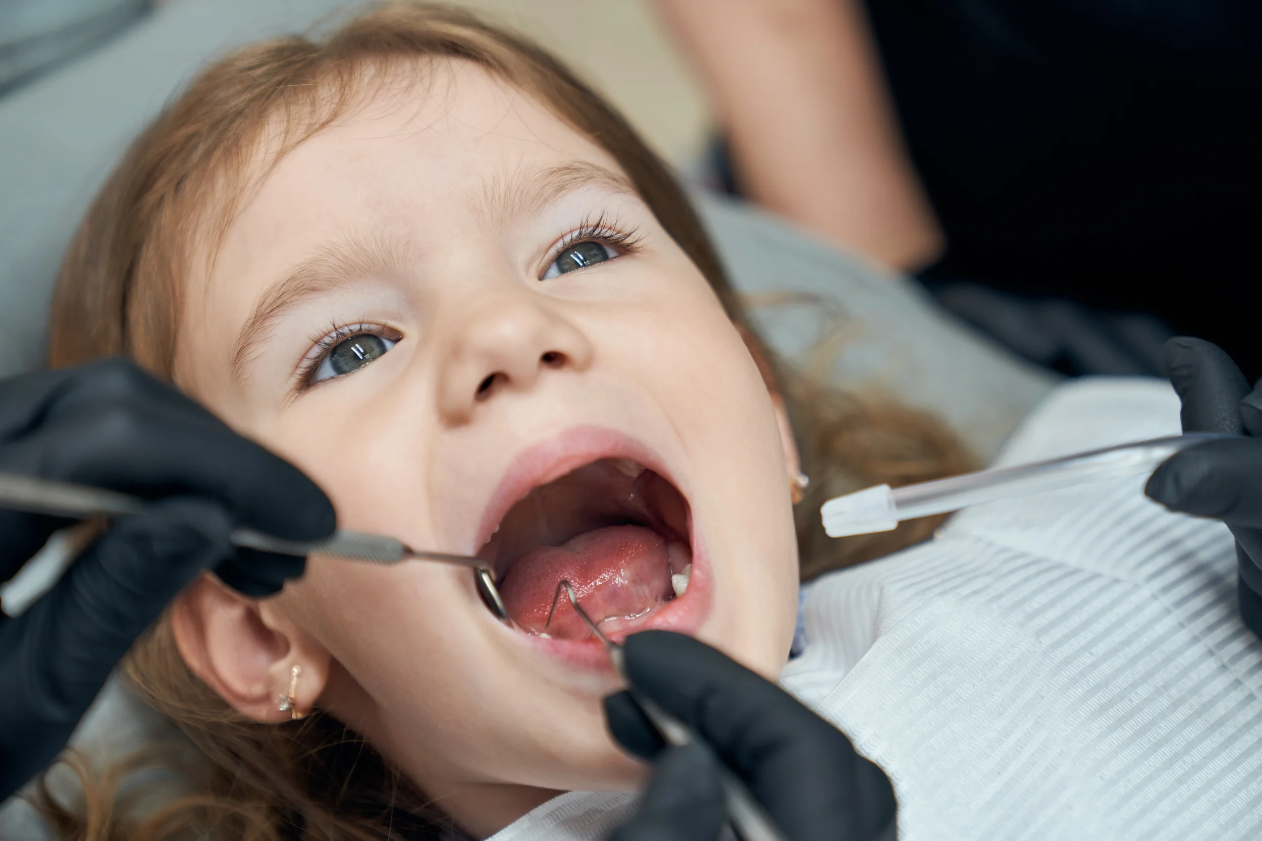 Caries en niños: cómo prevenirlas desde casa y cuándo ya es necesaria una visita al dentista