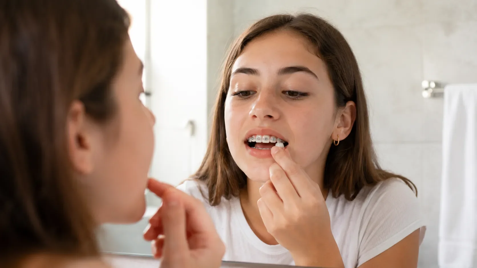 Urgencias con brackets: qué hacer si se despega o pincha un alambre