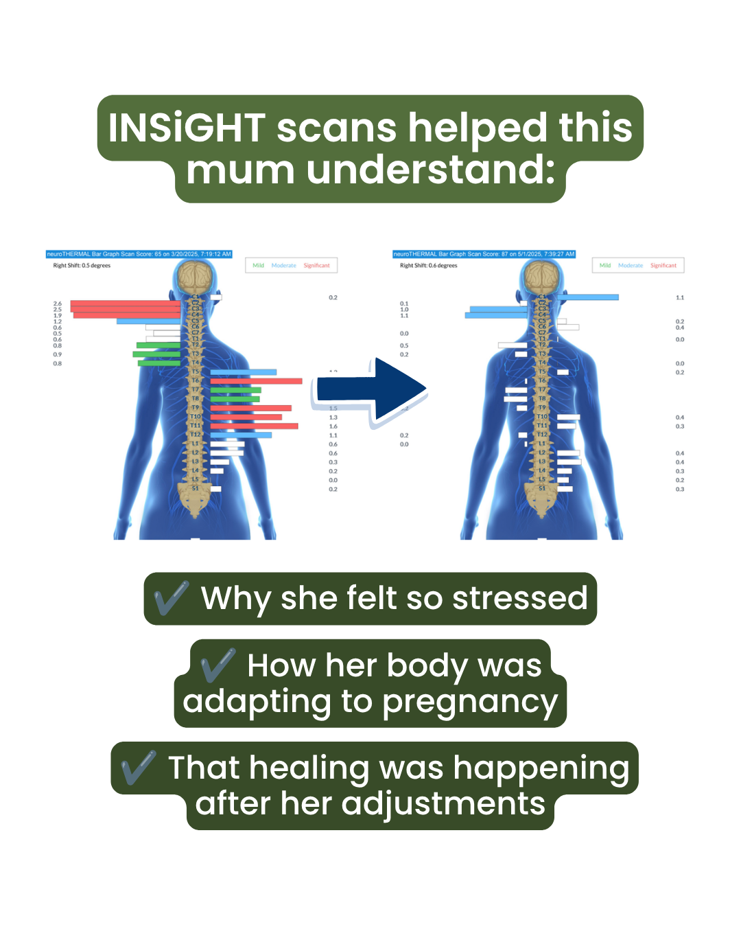 Don’t Miss This Test During Pregnancy&nbsp;