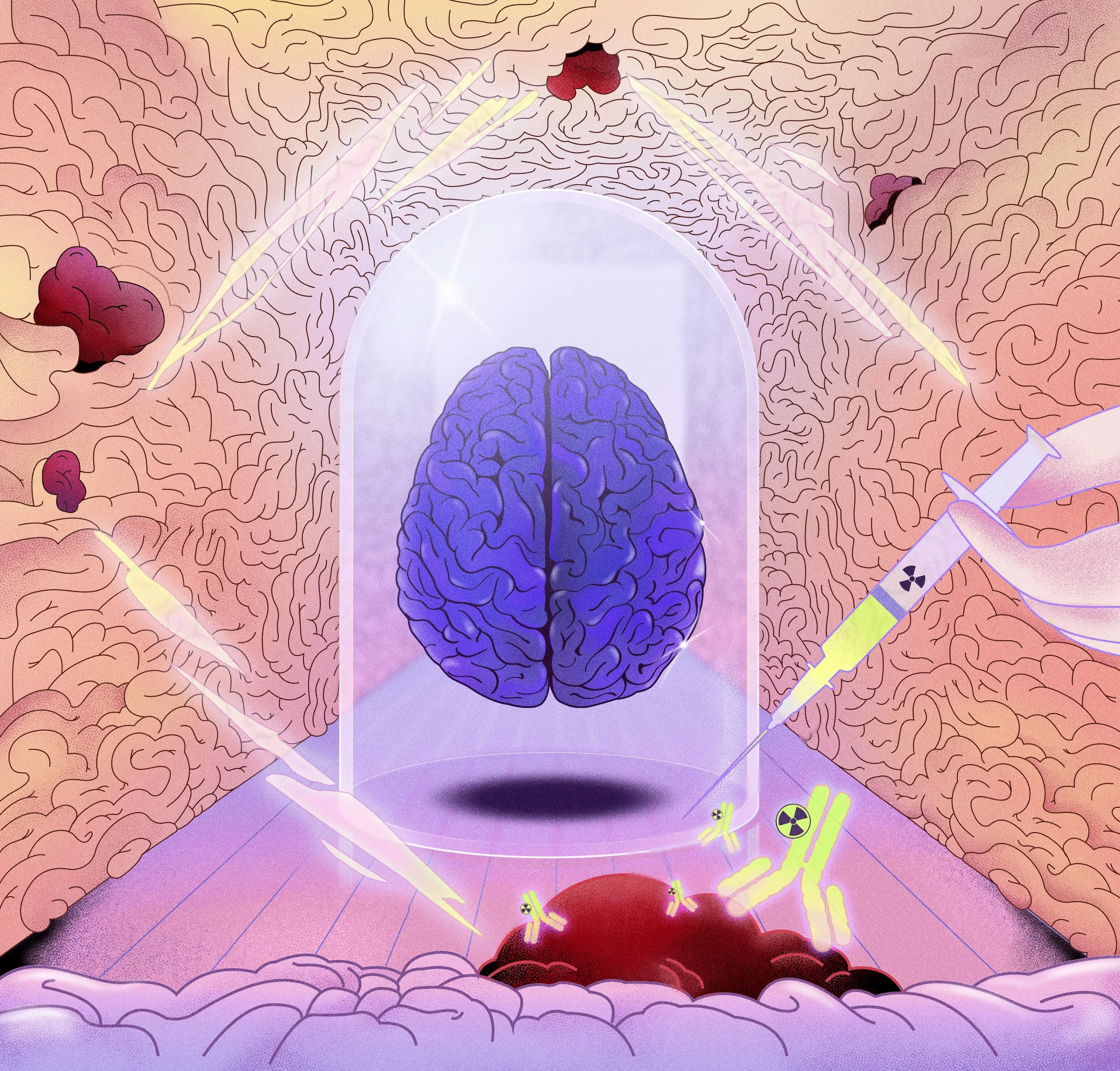 ColoV1_B2_EBM_Brain intratumoural astatine-211 radiotherapy targeting_COVER.jpg