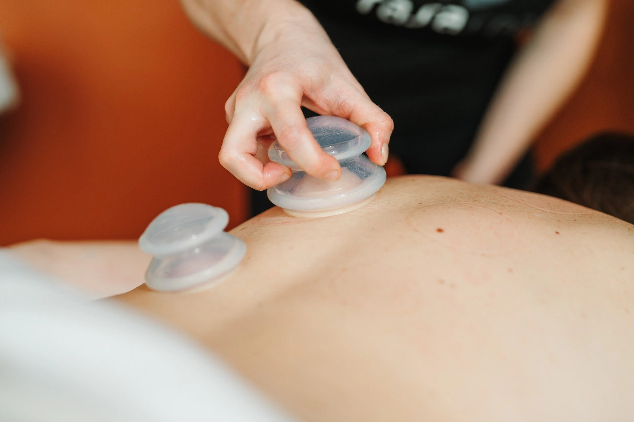 Rasa_Cupping-Back 07.jpg