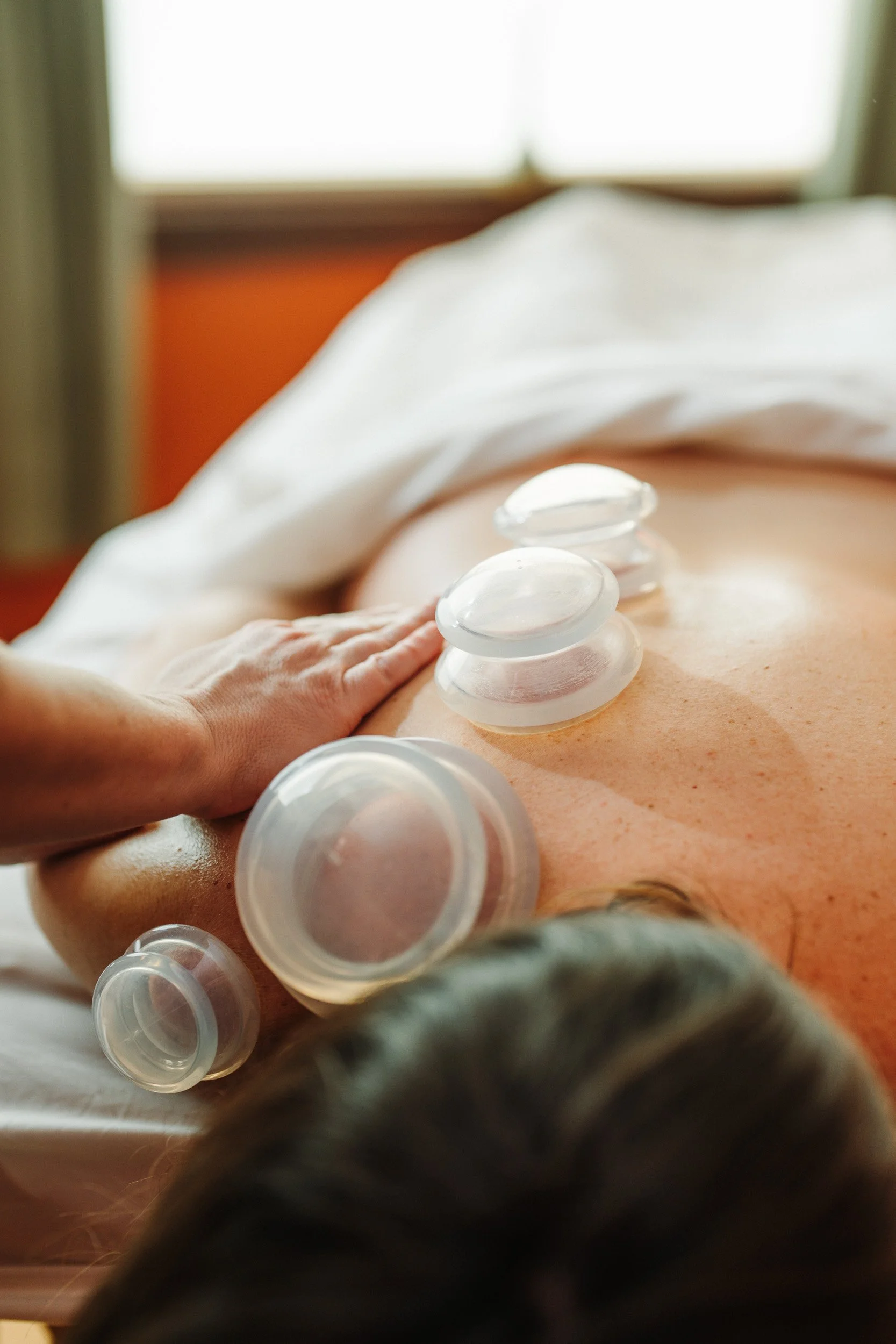 10.11.26 - Therapeutic Cupping with Katie Barnes, LMT