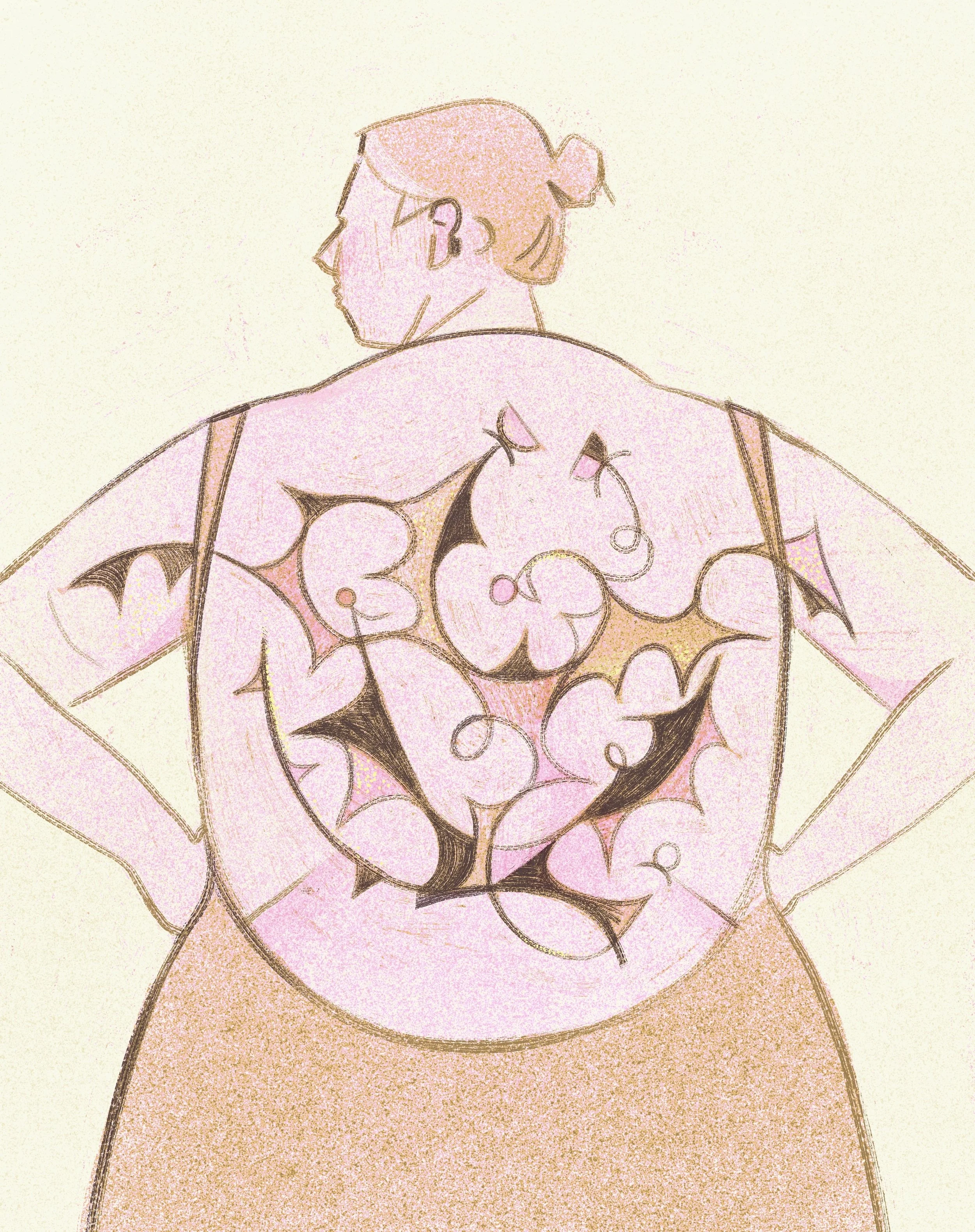 Endometriosis Poster