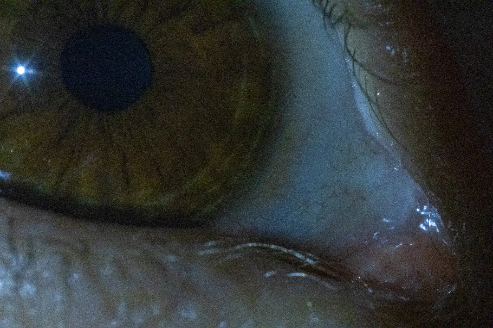 Close-up of a human eye showing the iris, pupil, and sclera with detailed blood vessels and reflections of light.