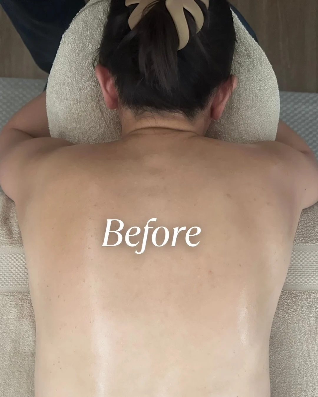 Before and after a focused upper back and shoulder treatment

Subtle changes, but often a noticeable difference in how the body feels

This is what recovery can look like

Book yours today