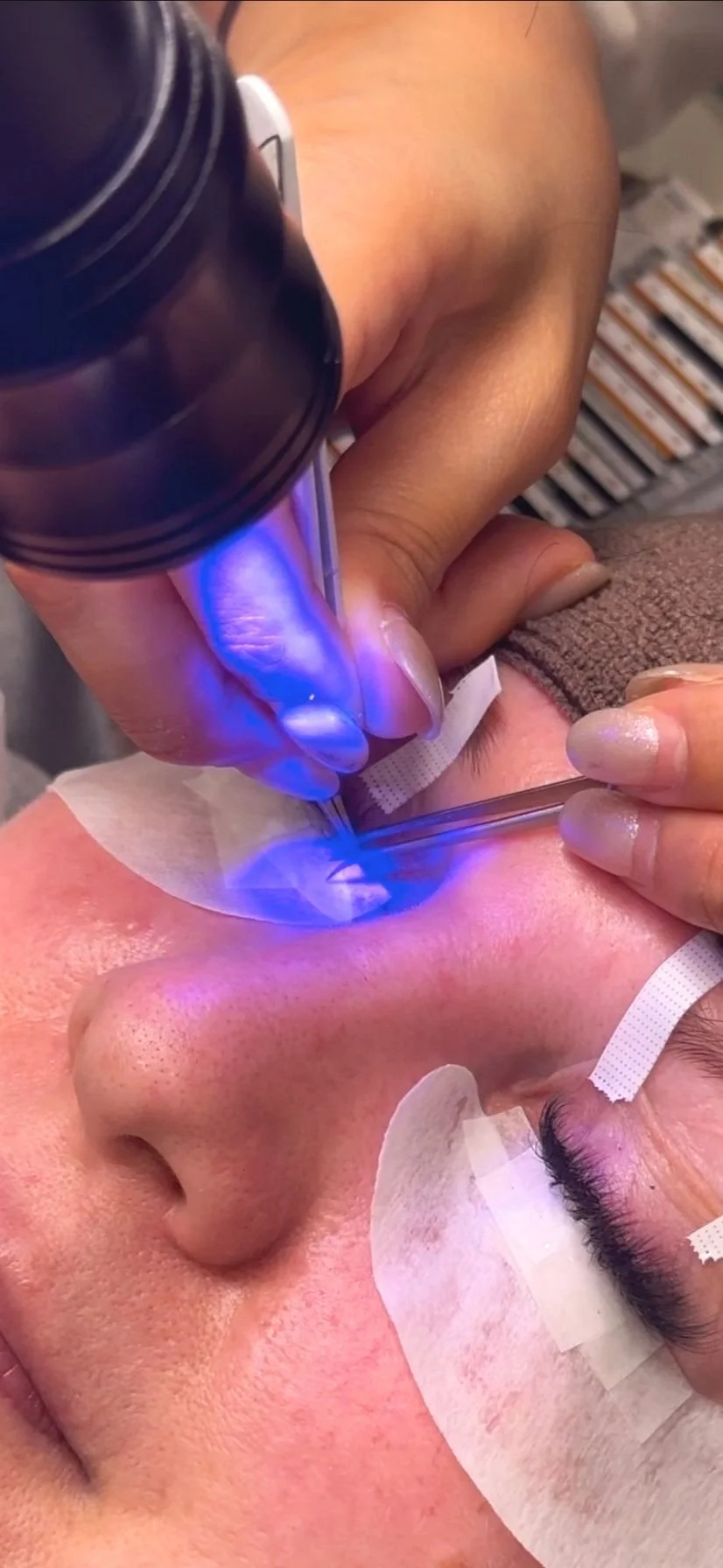 Close-up of a person undergoing eyelash extension application using blue light and tweezers.