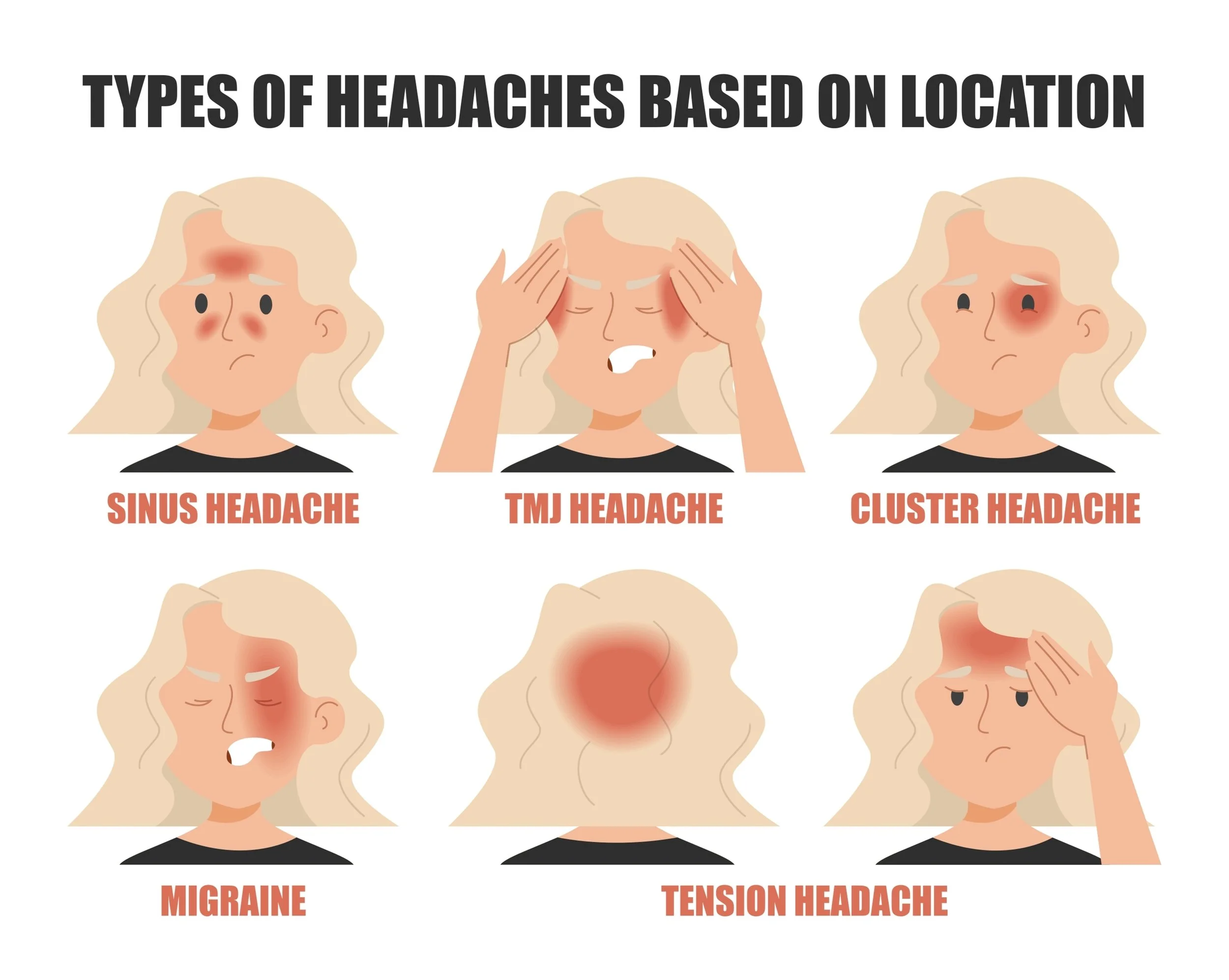 An infographic titled 'Types of Headaches Based on Location' displaying six illustrations of a woman with different head pain areas. The first shows sinus headache with pain around the nose and forehead. The second shows TMJ headache with pain on both sides of the jaw. The third depicts a cluster headache with intense pain around one eye. The fourth illustrates migraine with intense pain on one side of the head. The fifth shows a tension headache with diffuse pain all over the head. The sixth displays a person with a headache on the forehead.