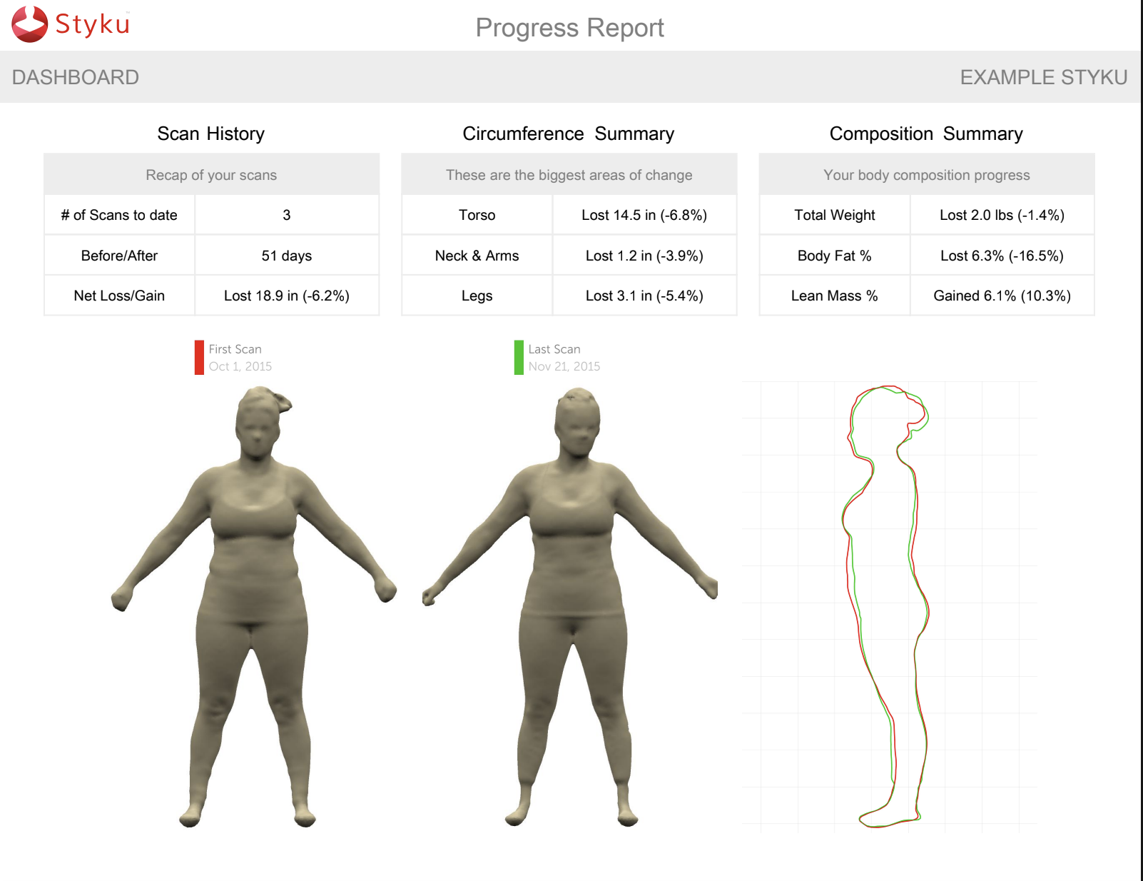 Progress report dashboard displaying scan history, circumference summary, and body composition summary. It includes 3 scans over 51 days with a net loss of 18.9 inches (-6.2%). Visuals show 3D body models from initial and recent scans, with a line graph comparing body outlines.