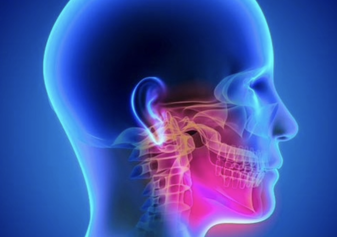 Temporal Mandibular Disorder/TMD