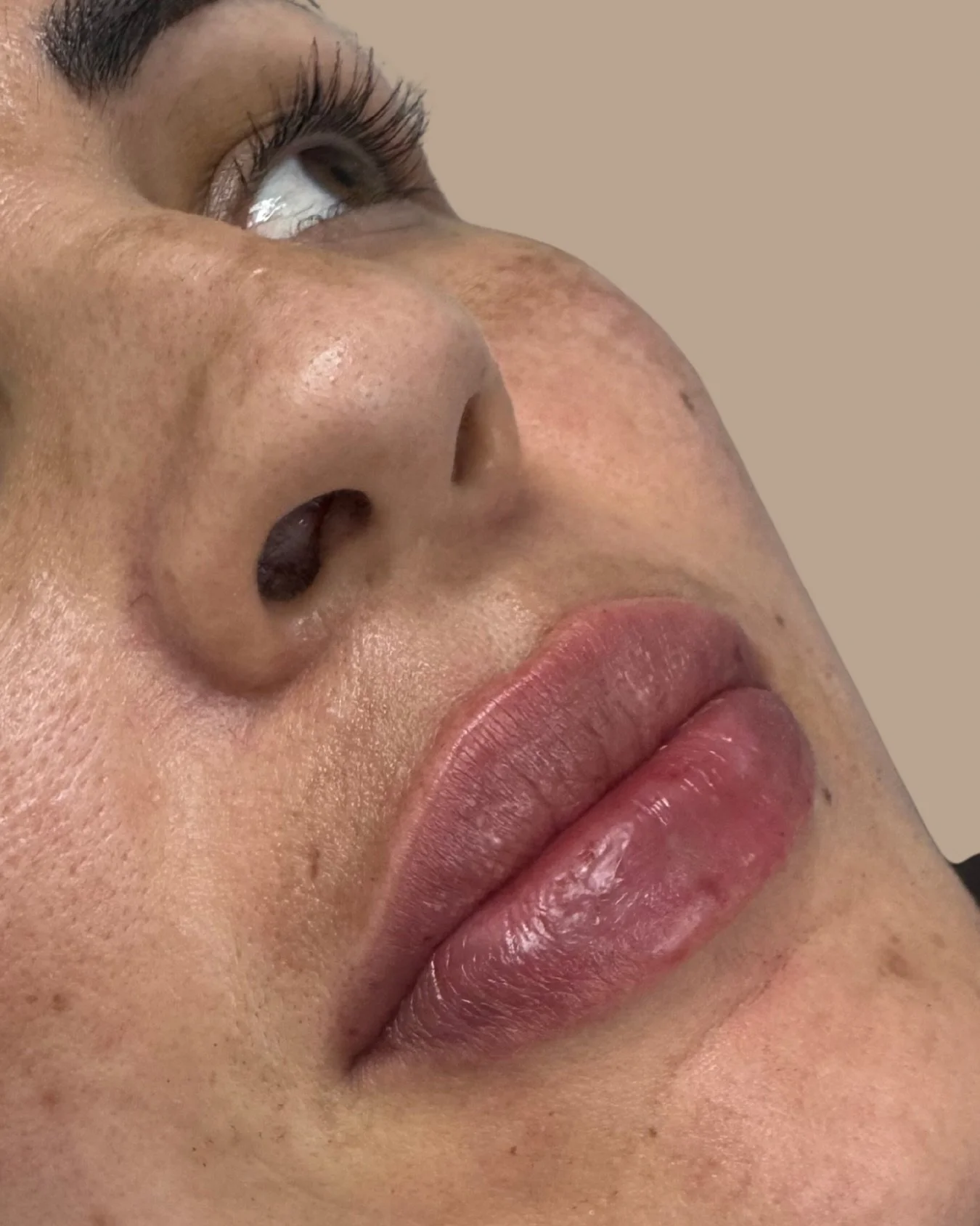 Precision, balance, and a gentle approach.
Enhancing structure while maintaining softness  because natural doesn’t mean minimal, it means you.
#AliraAesthetics #YourBeautyYourPace
#SydneyCityBeauty #BelmoreCosmeticClinic #SydneyAesthetics #Sy