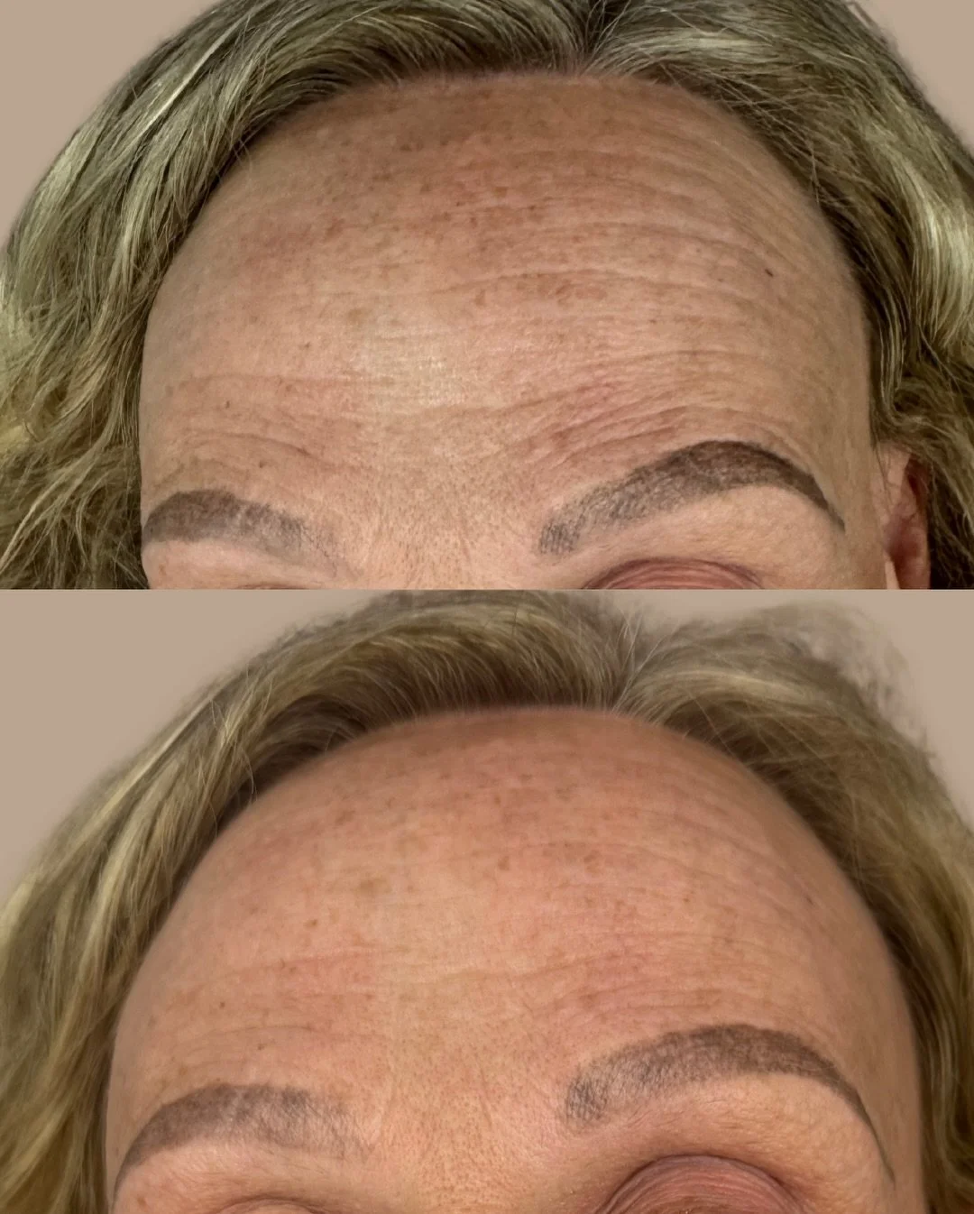 PRX the no needle, no downtime skin glow treatment ✨

This treatment is perfect if you want fresh, radiant skin without needles or recovery time.
It&rsquo;s quick, comfortable, and gives the skin an instant brightness clients love for events, holiday