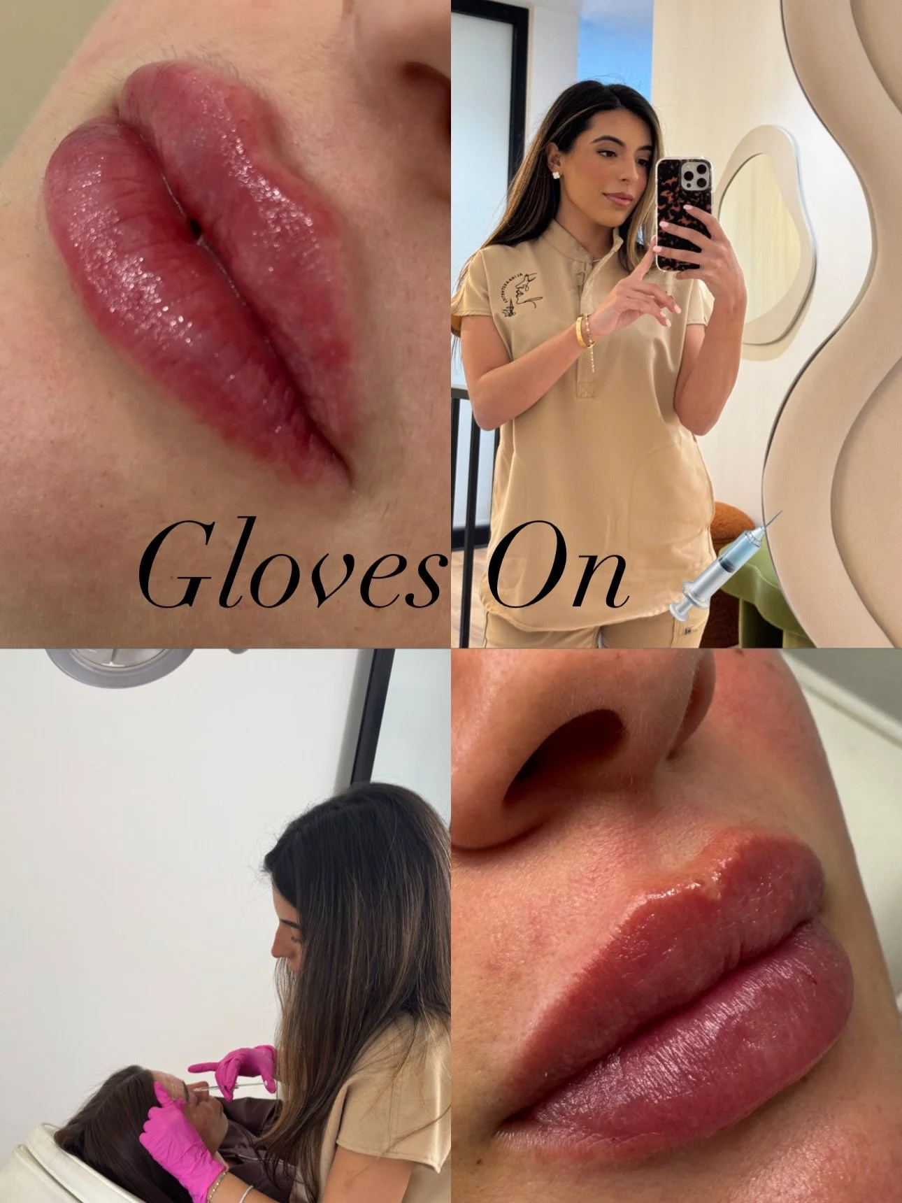 Gloves on vs Gloves off 🤍 #sydneycosmeticnurse